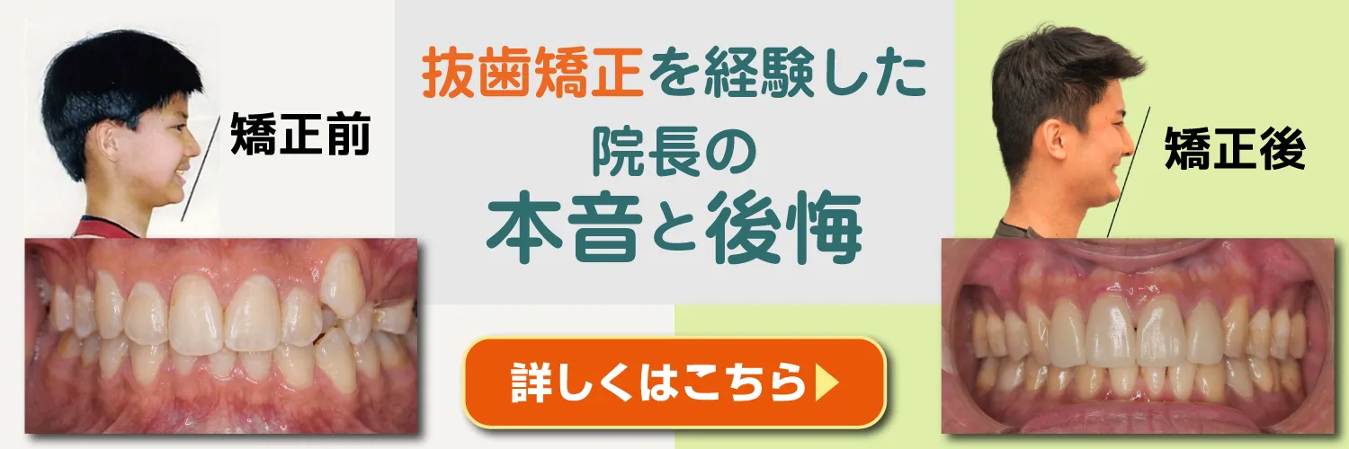 抜歯矯正を経験した院長の本音と後悔 詳しくはこちら