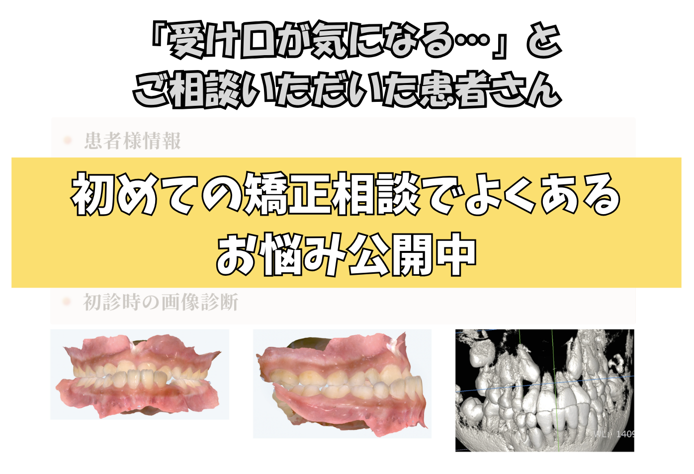 「受け口が気になる…」とご相談いただいたY.Tさん（10歳女の子）のケース