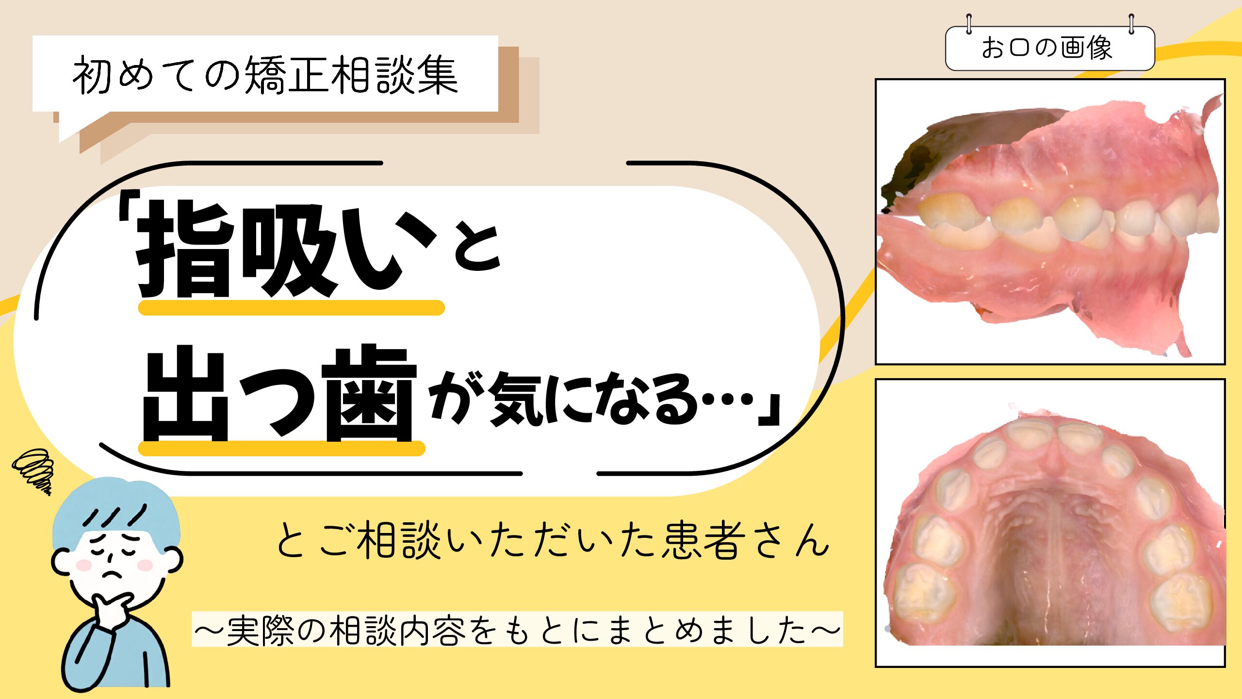 「指吸いと出っ歯が気になる…」とご相談いただいたH.Sさん（5歳・男の子）のケース