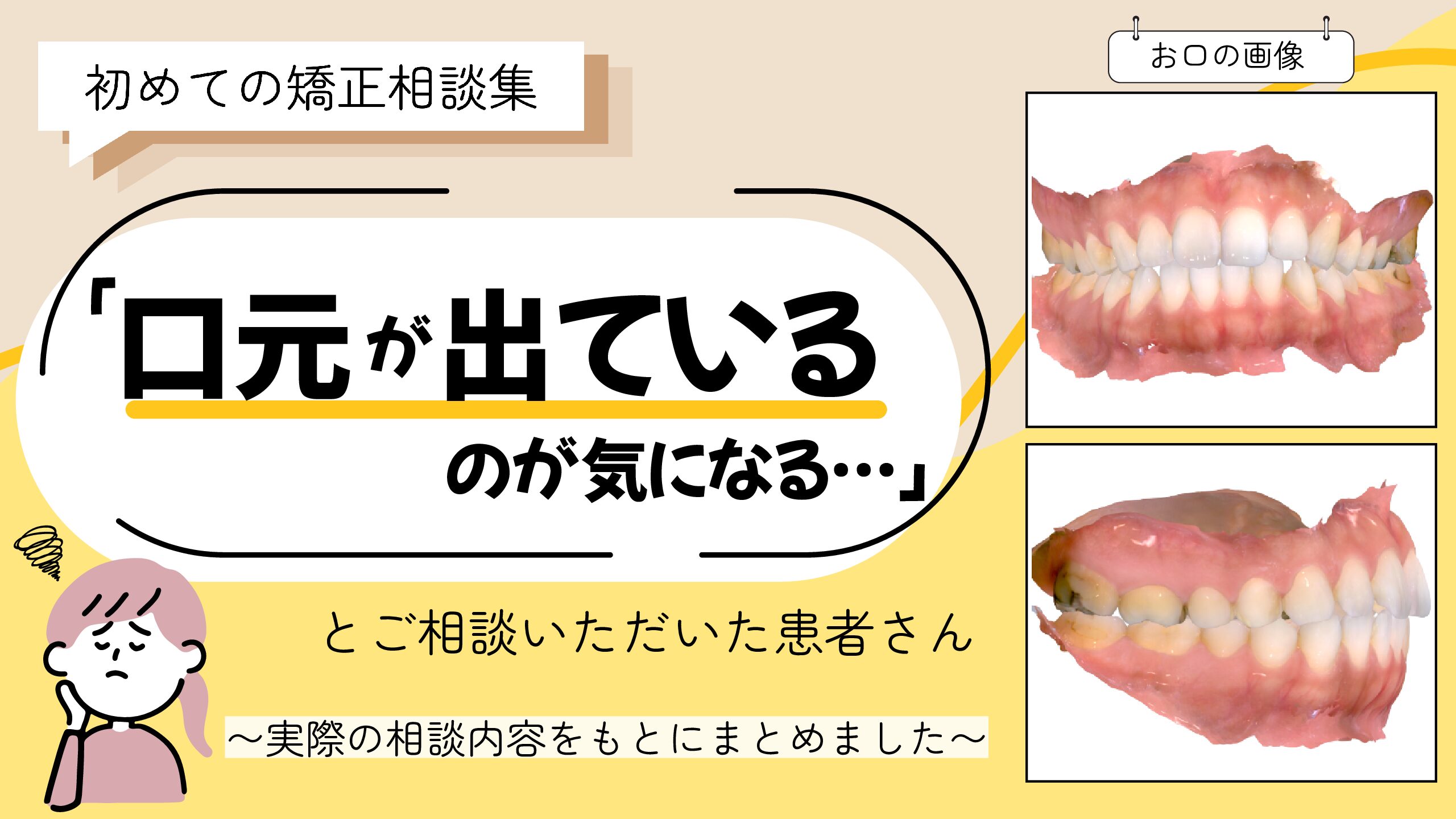 「口元が出ているのが気になる…」とご相談いただいたK.Mさん（28歳・女性）のケース