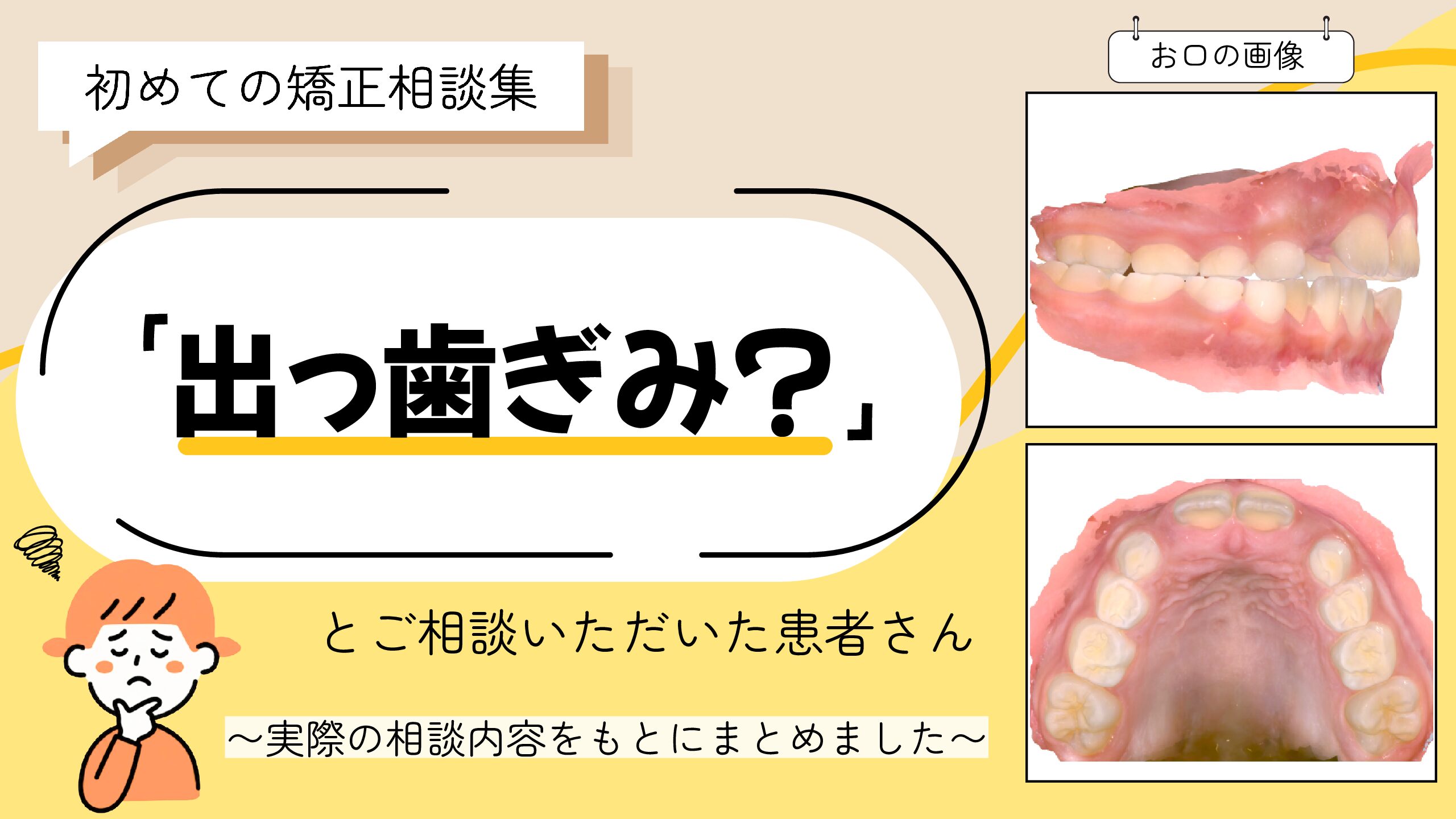 「出っ歯ぎみ？」とご相談いただいたN.Mさん（7歳・女の子）のケース