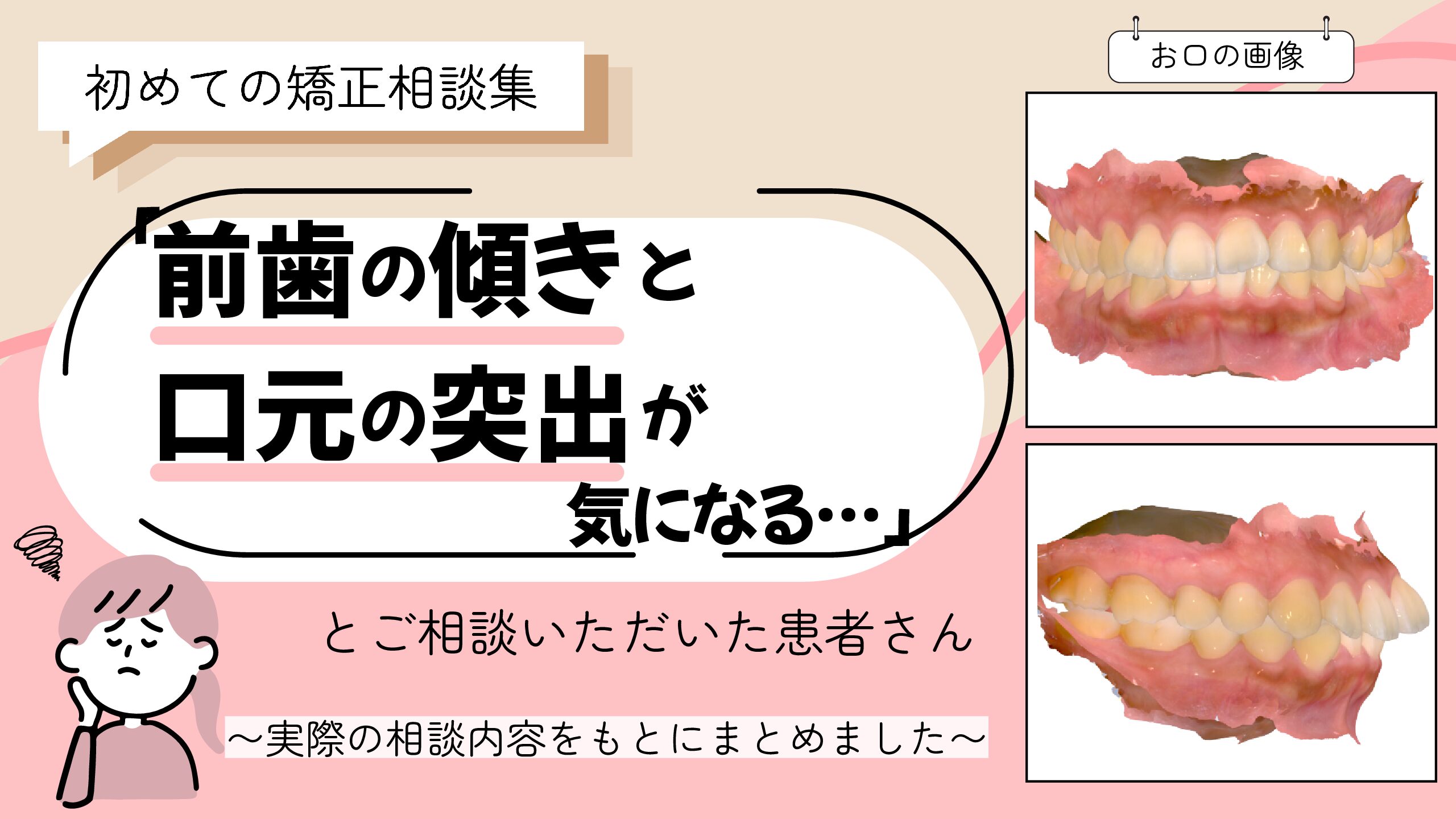 「前歯の傾きと口元の突出が気になる…」とご相談いただいたN.Rさん（24歳・女性）のケース