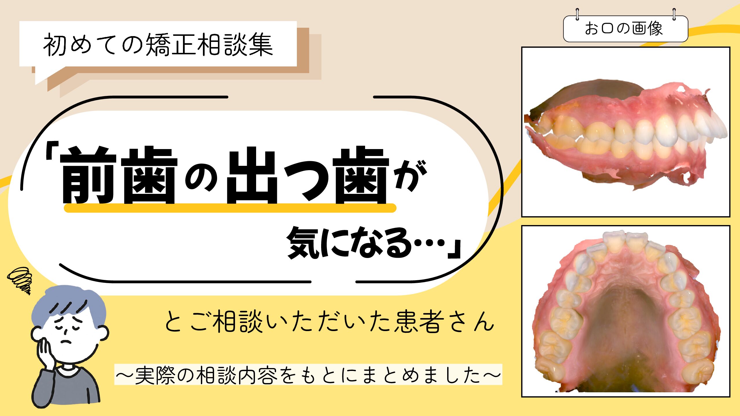 「前歯の出っ歯が気になる…」とご相談いただいたS.Rさん（24歳・男性）のケース