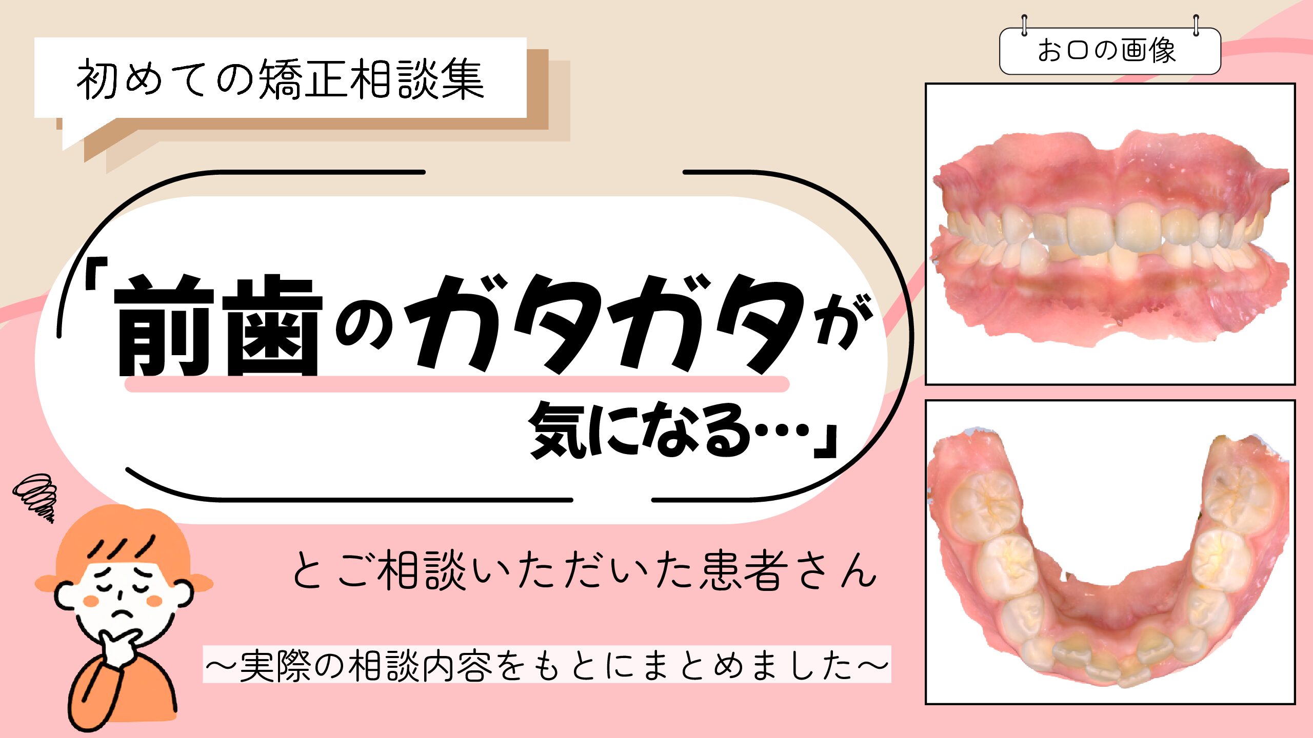 「前歯のガタガタが気になる」とご相談いただいた T.Kさん（8歳・女の子）のケース