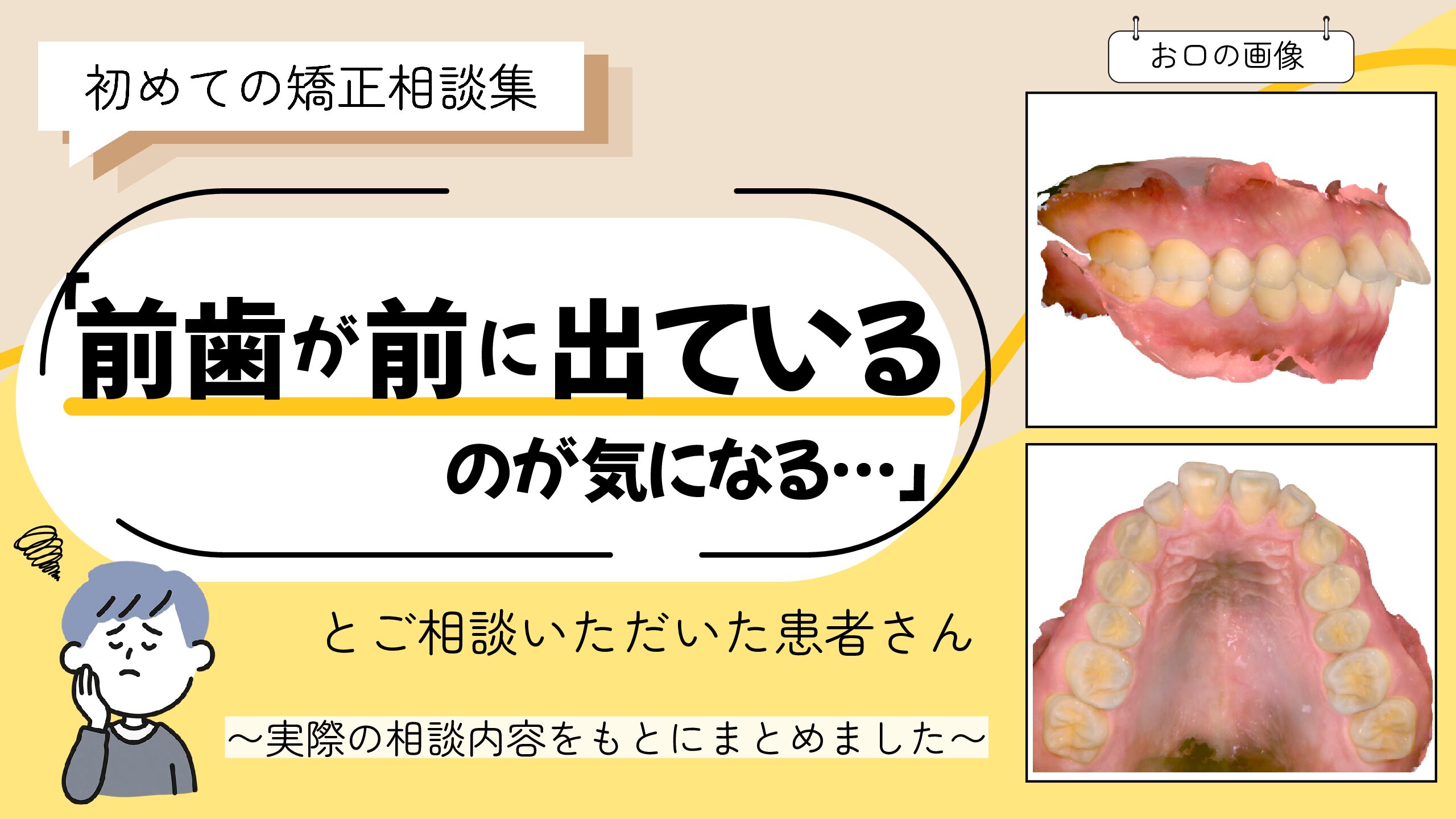 「前歯が前に出ているのが気になる…」とご相談いただいたT.Tさん（31歳・男性）のケース