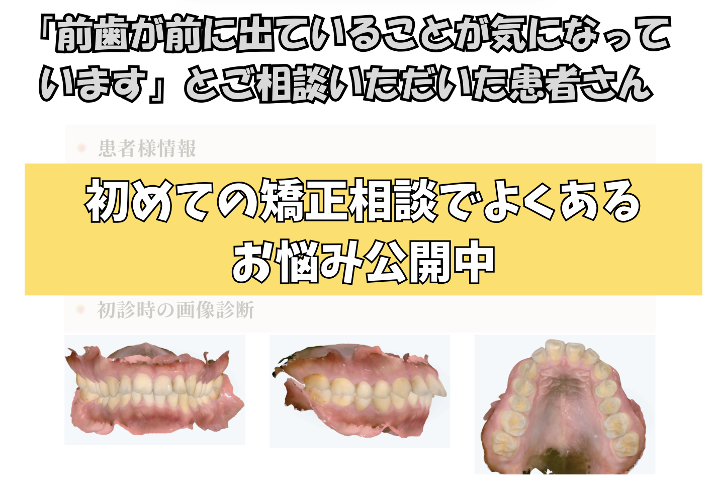 「前歯が前に出ていることが気になっています」とご相談いただいたT.Tさん（31歳・男性）のケース