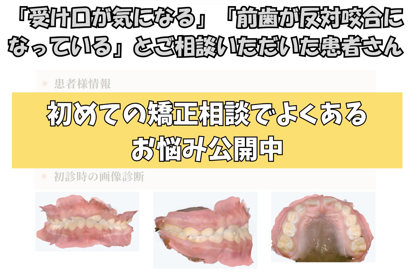 「受け口が気になる」「前歯が反対咬合になっている」とご相談いただいたK.Sさん（7歳女の子）のケース