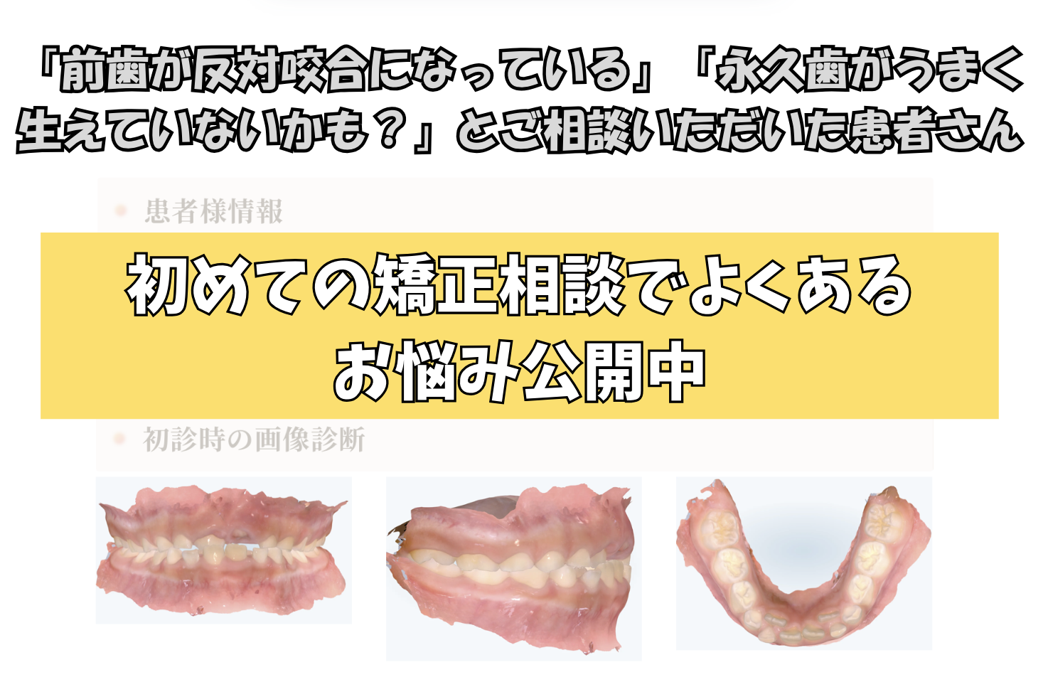 「前歯が反対咬合になっている」「永久歯がうまく生えていないかも？」とご相談いただいたM.Kさん（7歳・女の子）のケース
