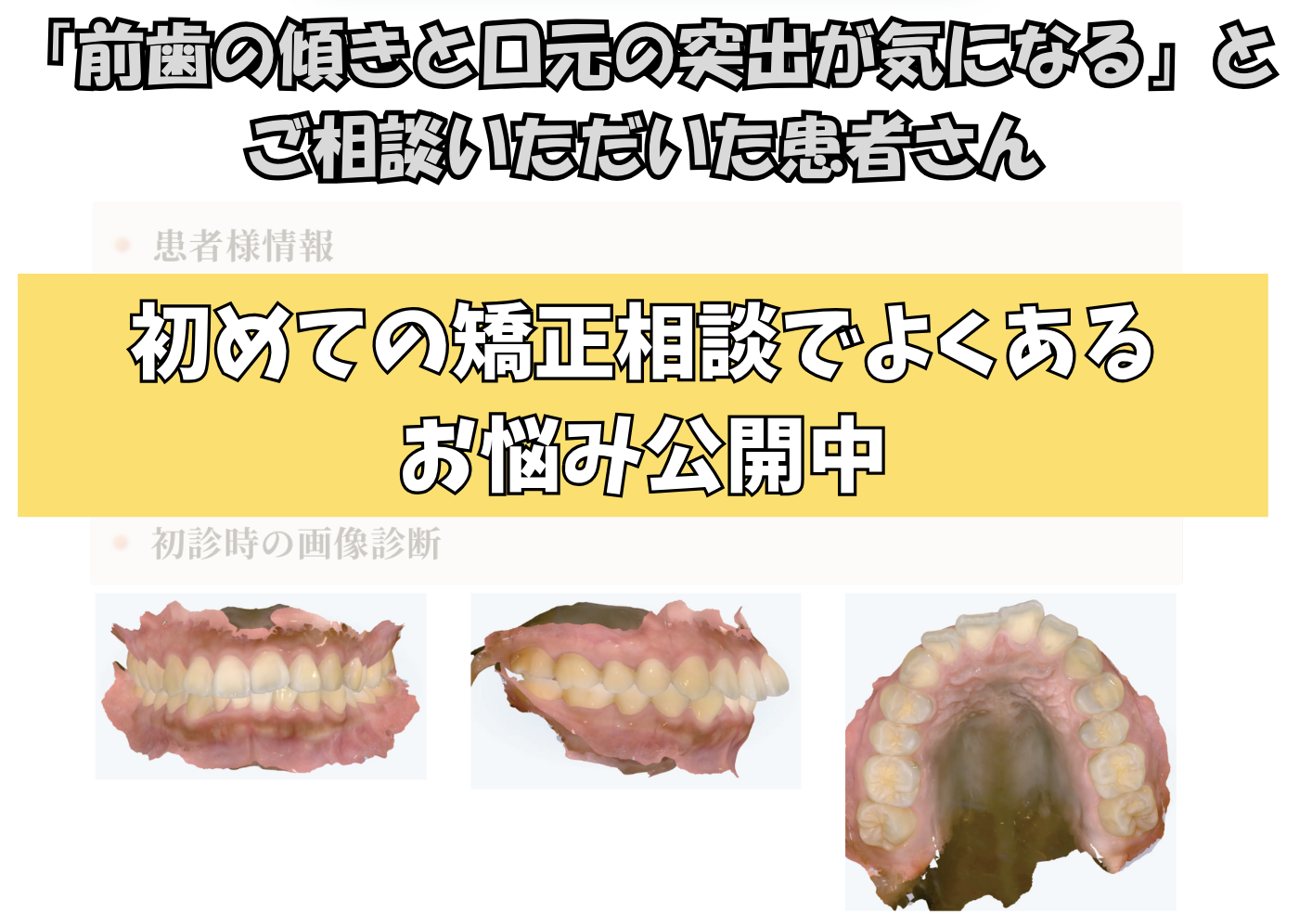 「前歯の傾きと口元の突出が気になる」とご相談いただいたN.Rさん（24歳・女性）のケース