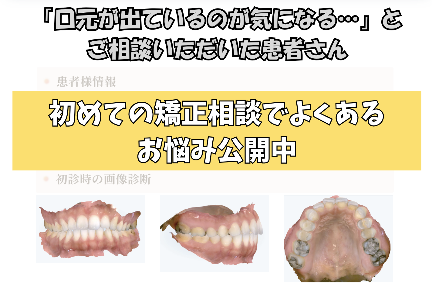 「口元が出ているのが気になる…」とご相談いただいたK.Mさん（28歳・女性）のケース