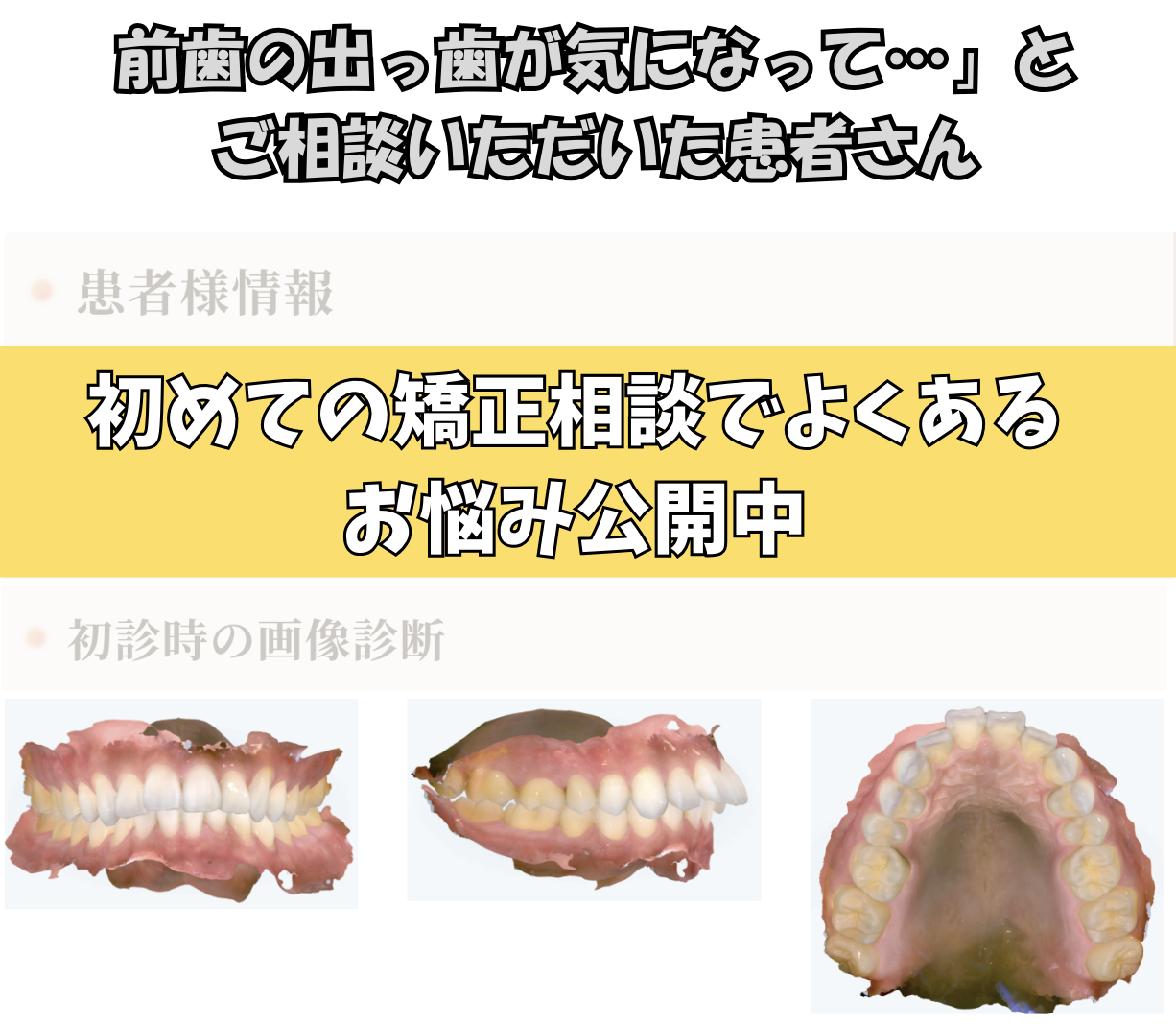 「前歯の出っ歯が気になって…」とご相談いただいたS.Rさん（24歳・男性）のケース