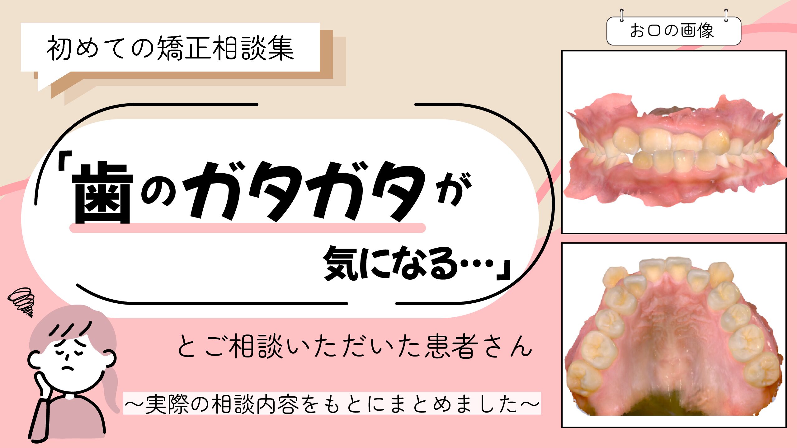 「歯のガタガタが気になる」とご相談いただいたA.Mさん（20歳・女性）のケース