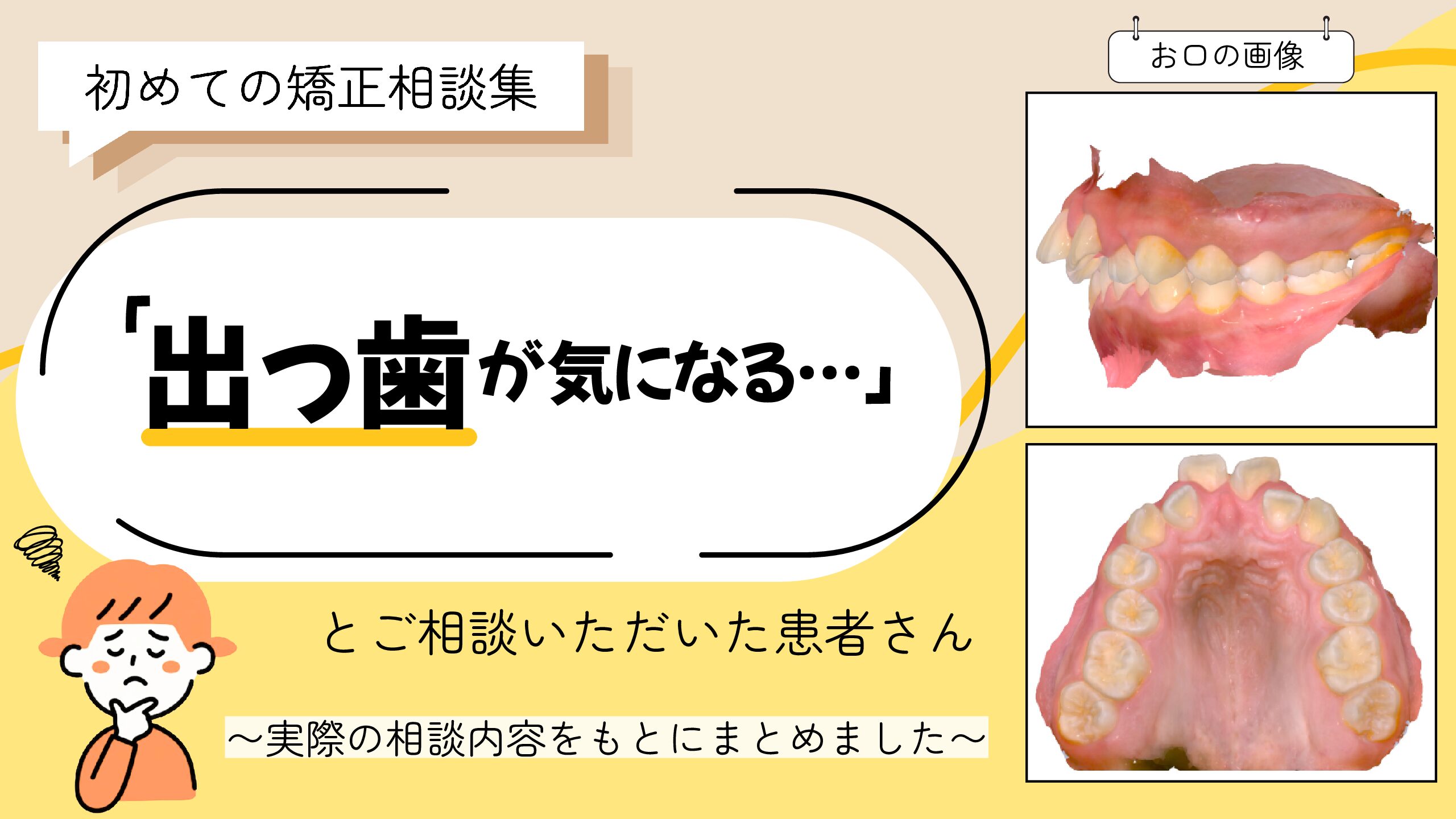 「出っ歯が気になる・・・」とご相談いただいた F.Tさん（11歳・女の子）のケース