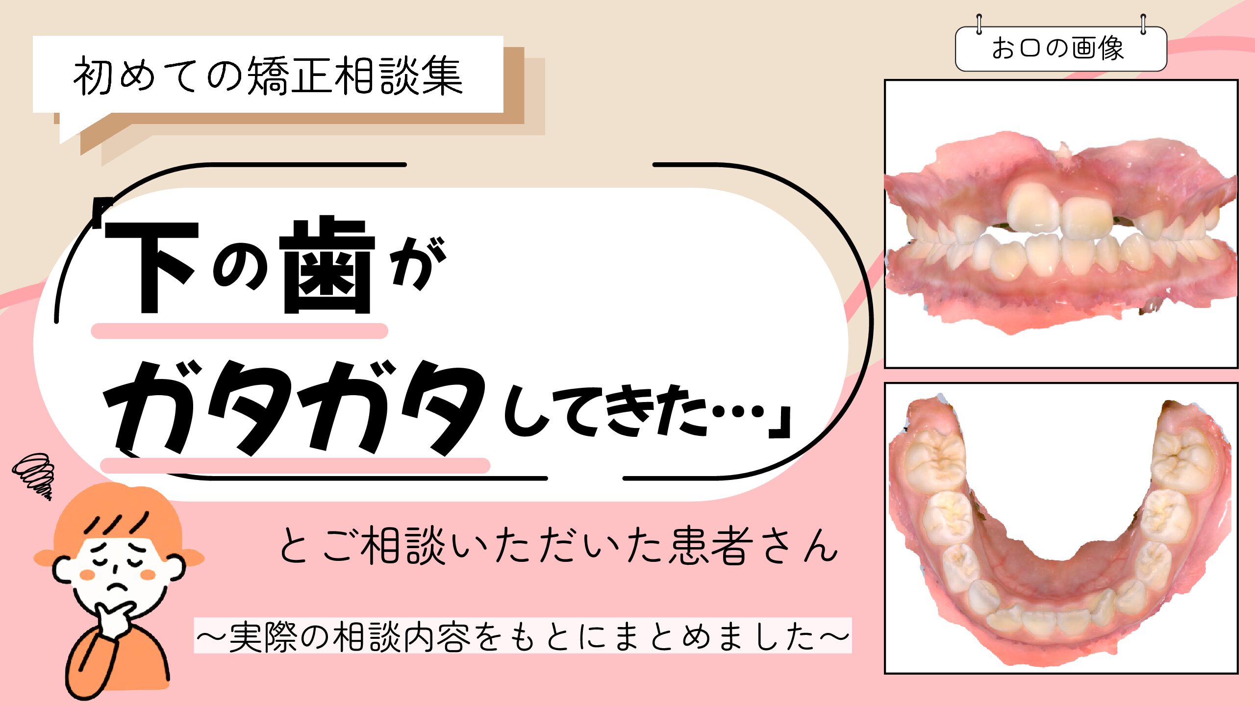 「下の歯がガタガタしてきた…」とご相談いただいたH.Kさん（7歳・女の子）のケース