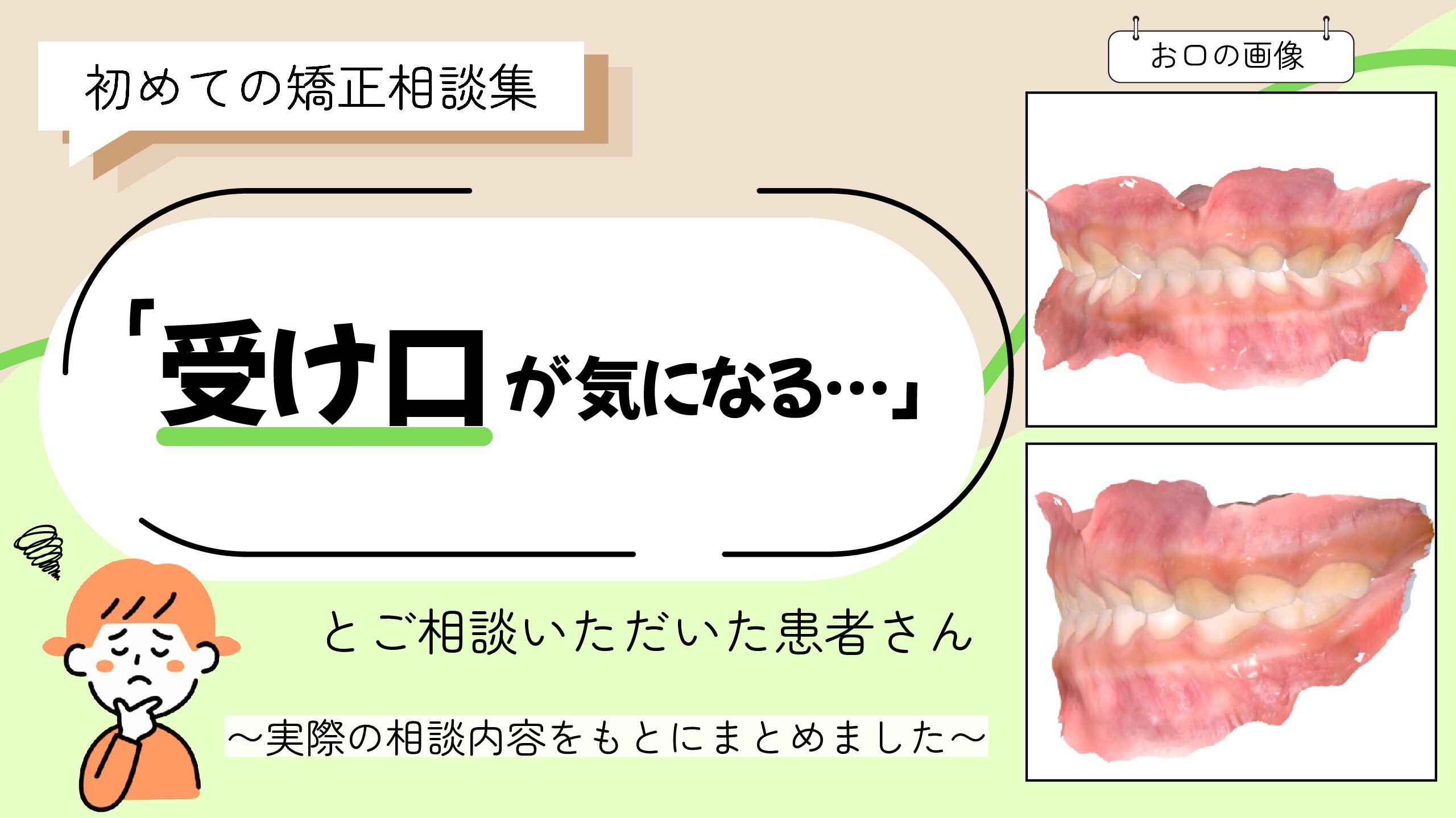 「受け口が気になる」とご相談いただいたI.Hさん（5歳・女の子）のケース