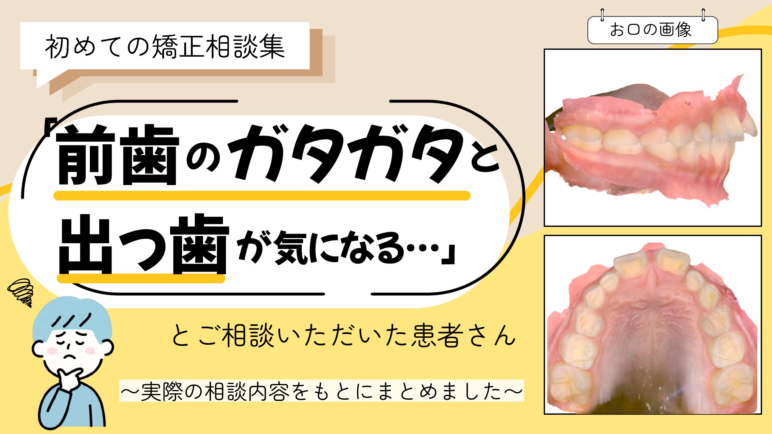 「前歯のガタガタと出っ歯が気になる」とご相談いただいた K.Kさん（8歳・男の子）のケース