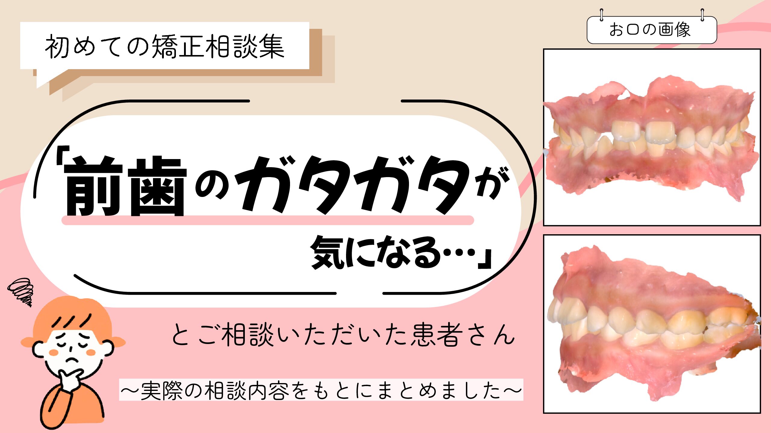 「前歯のガタガタが気になる」とご相談いただいた Mさん（7歳・女の子）のケース