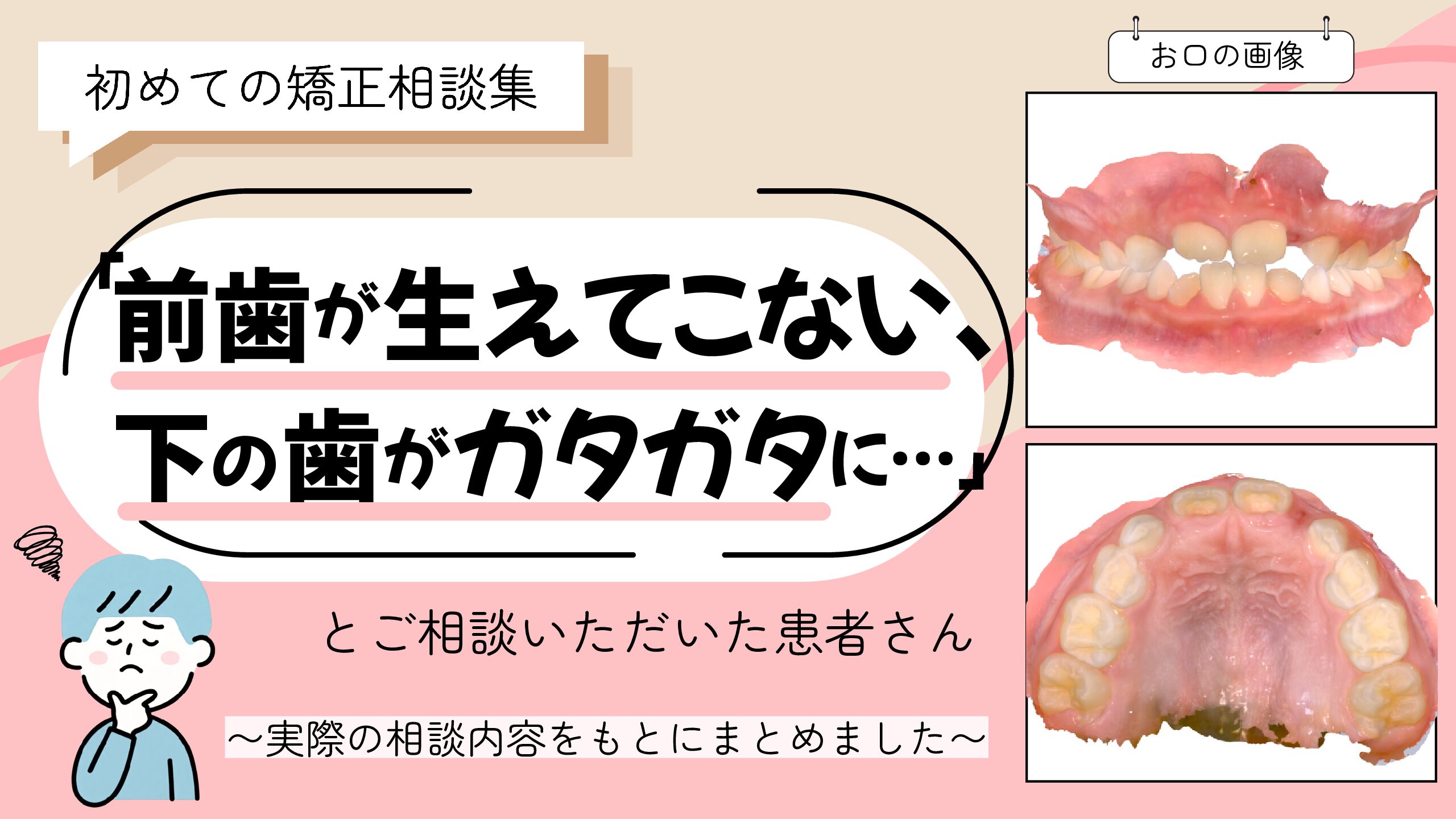 「前歯がなかなか生えてこない、下の歯がガタガタに…」とご相談いただいたS.Yさん（7歳・男の子）のケース