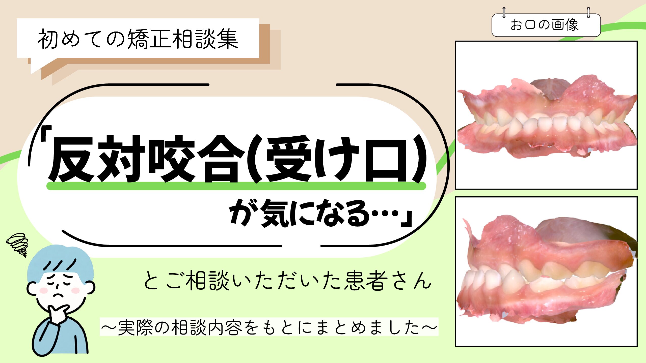 「反対咬合（受け口）が気になる」ご相談をいただいたT.Kさん（４歳・男の子）のケース