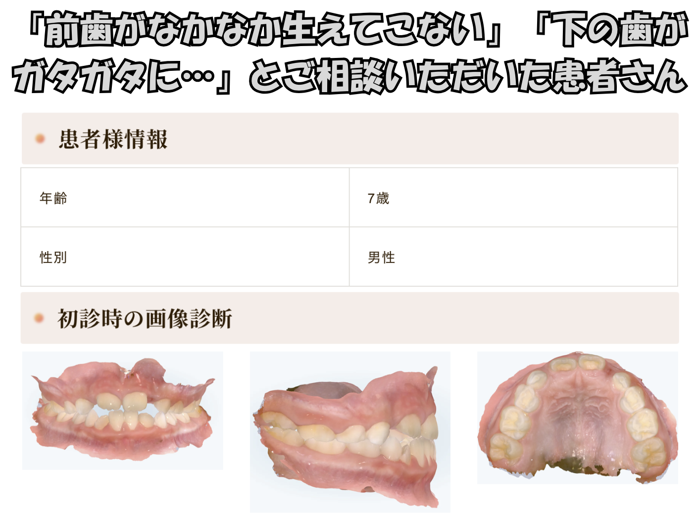 「前歯がなかなか生えてこない」「下の歯がガタガタに…」とご相談いただいたS.Yさん（7歳・男の子）のケース