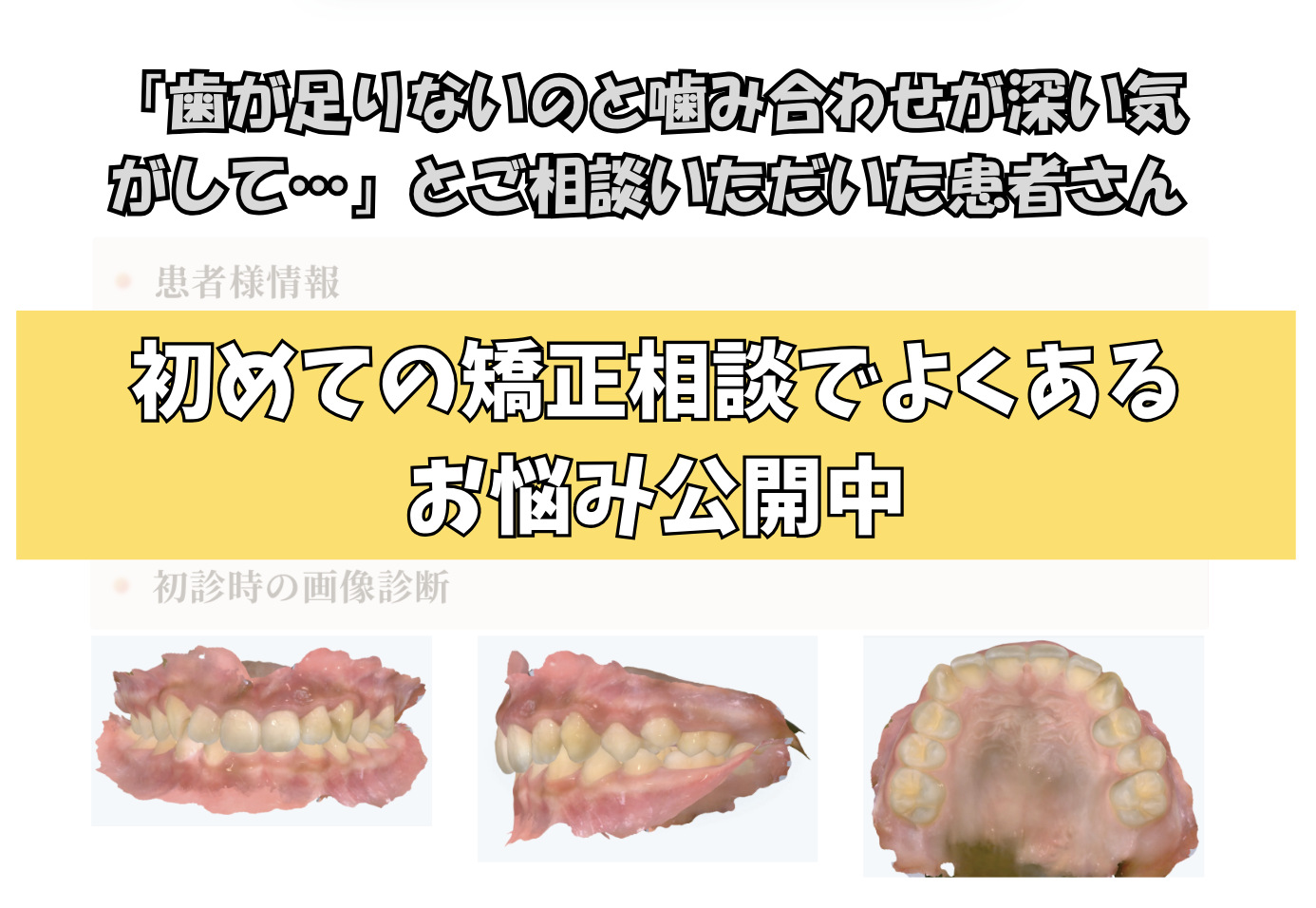 「歯が足りないのと噛み合わせが深い気がして…」とご相談いただいたT.Mさん（11歳・女の子）のケース