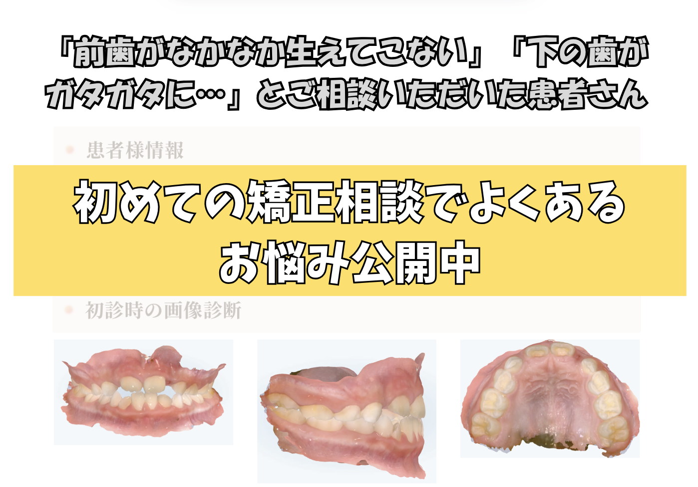 「前歯がなかなか生えてこない」「下の歯がガタガタに…」とご相談いただいたS.Yさん（7歳・男の子）のケース