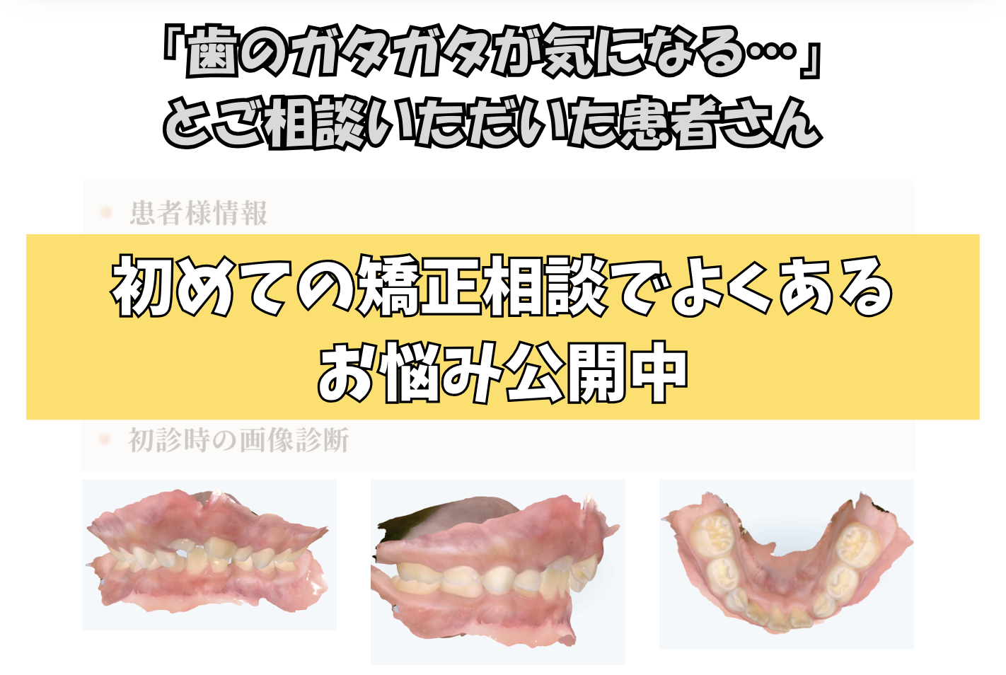 「歯のガタガタが気になる…」とご相談いただいた患者様のケース