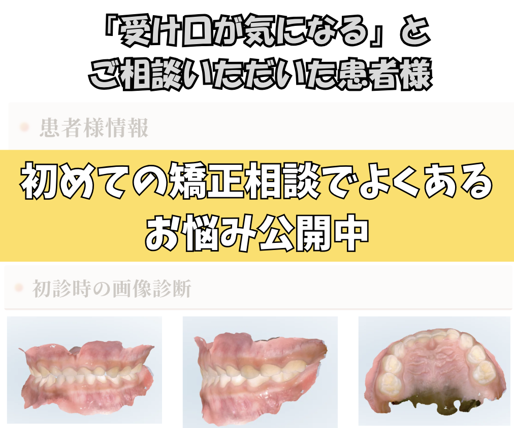 「受け口が気になる」とご相談いただいたI.Hさん（5歳・女の子）のケース