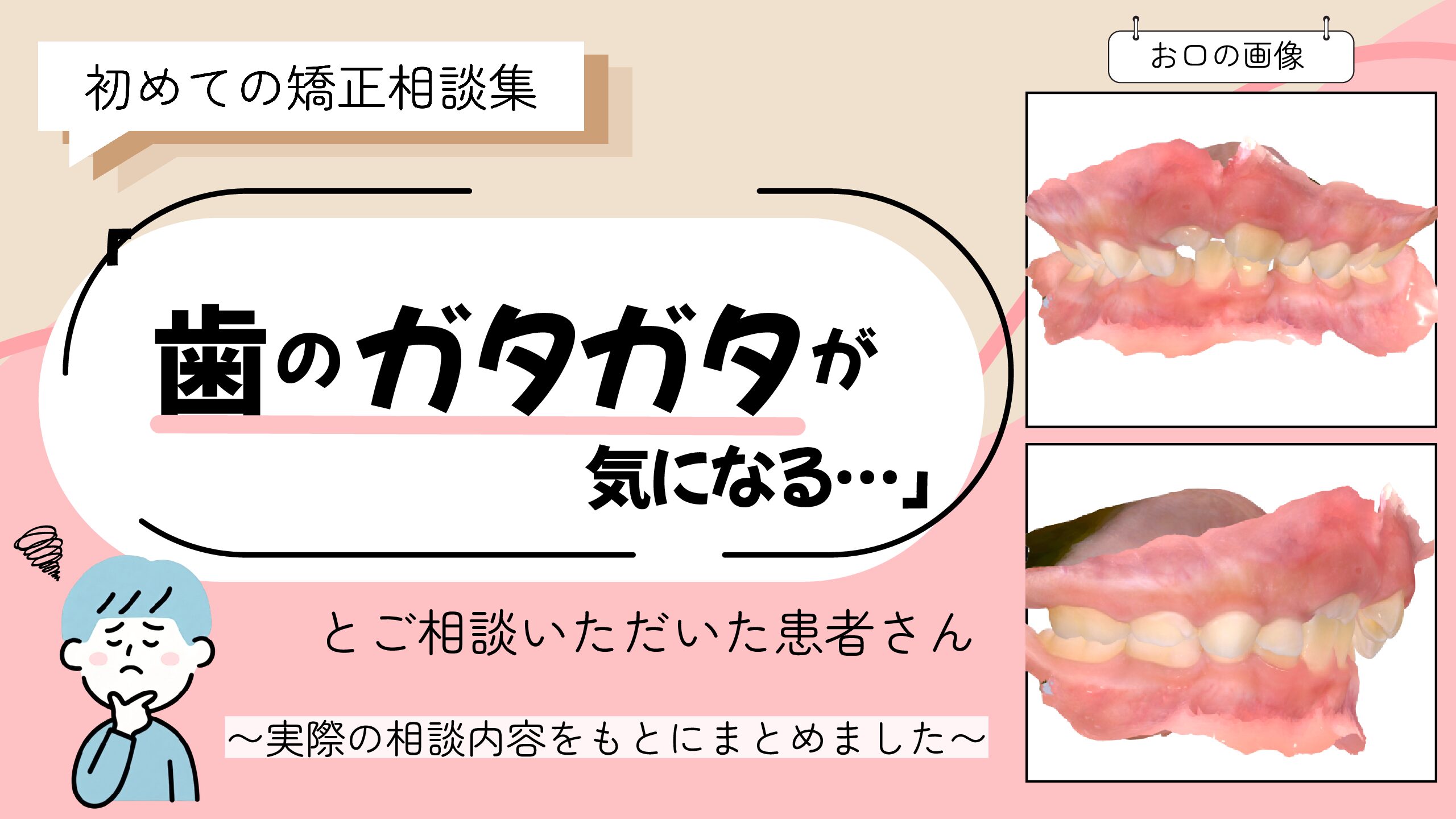 「歯のガタガタが気になる…」とご相談いただいた患者様のケース