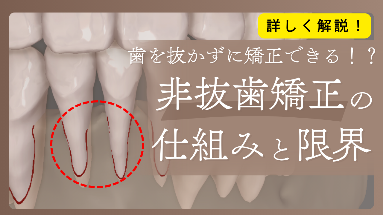 歯を抜かずに矯正できる！？非抜歯矯正の仕組みと限界を詳しく解説