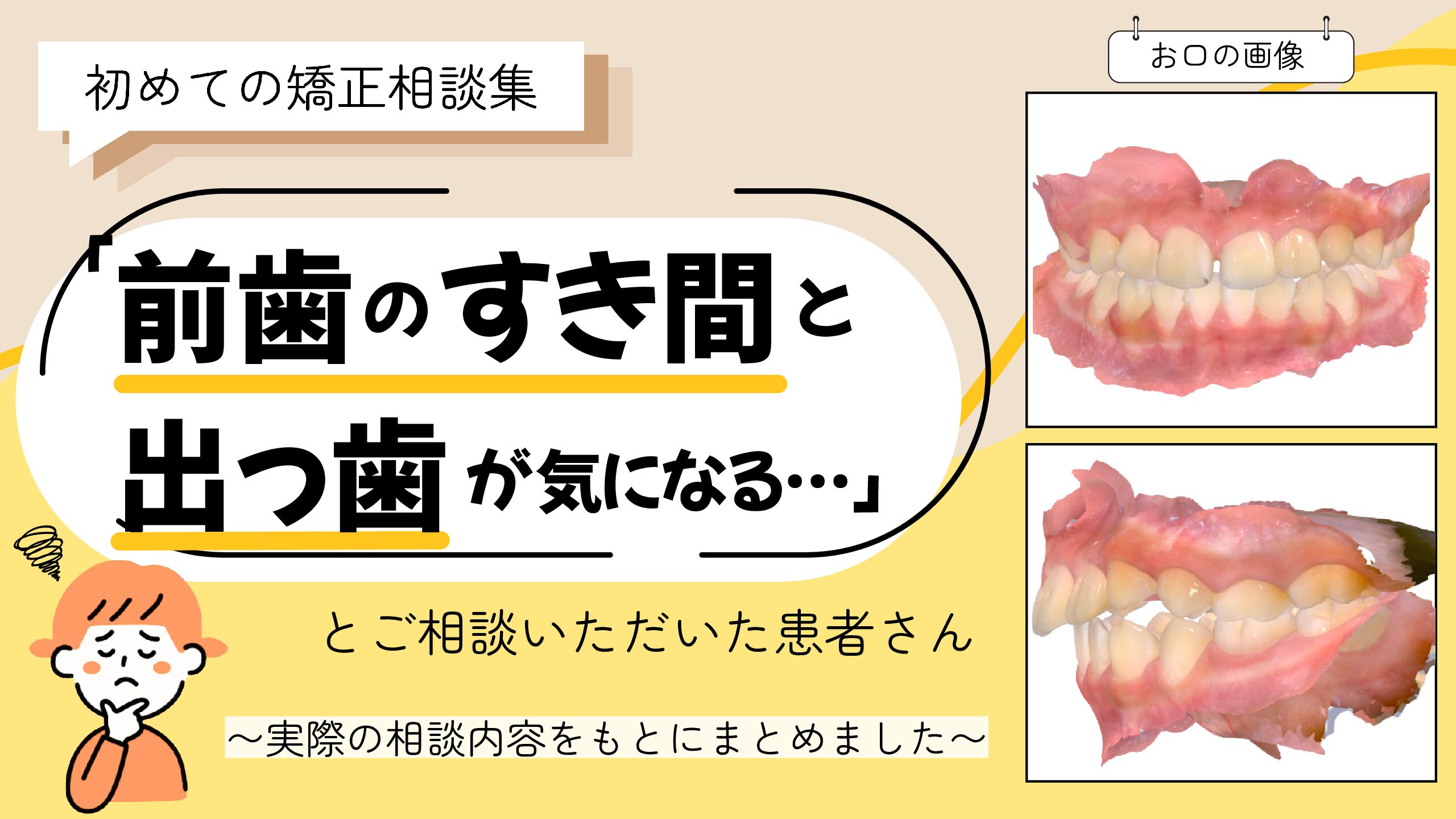 「前歯のすき間と出っ歯が気になる…」とご相談いただいた9歳・女の子のケース