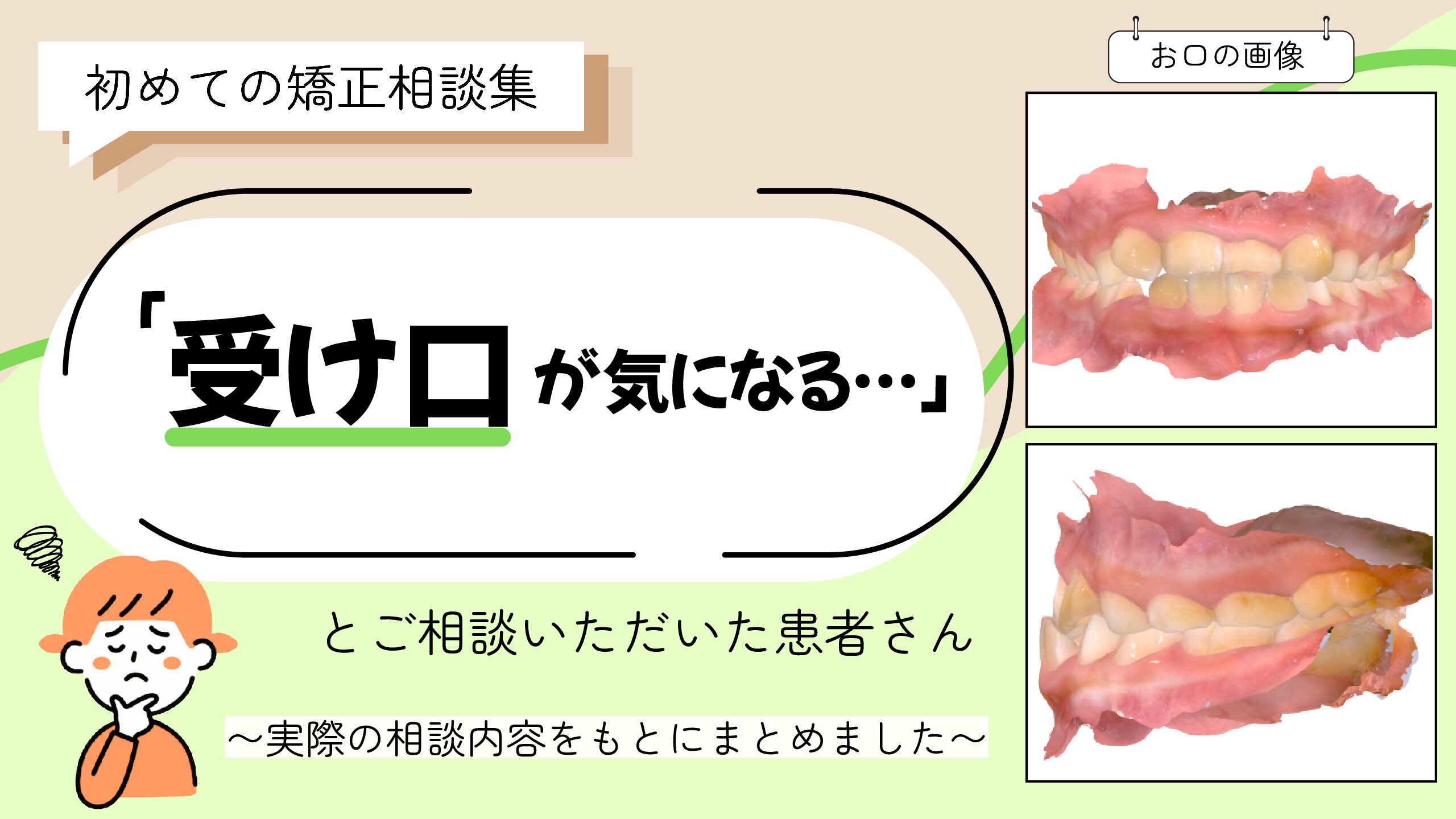 「受け口が気になる」とご相談いただいた Kさん（8歳・女の子）のケース