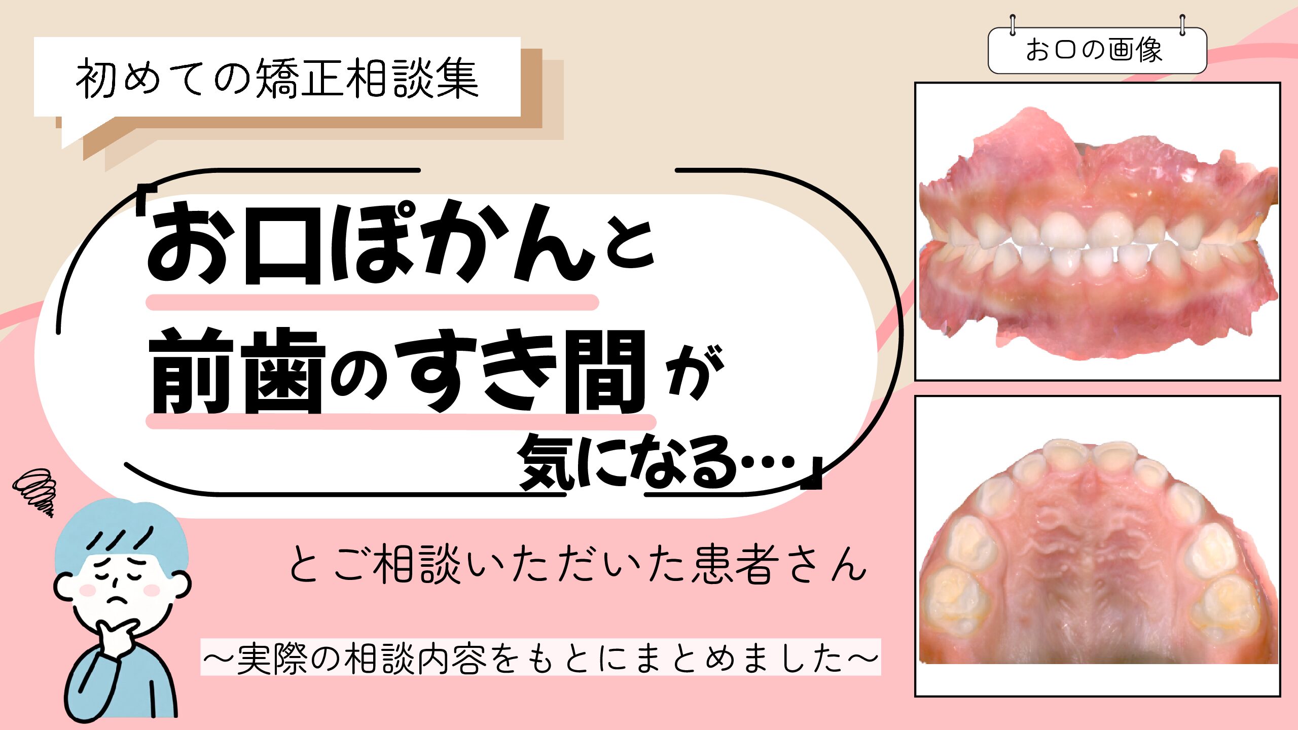 「お口ぽかんと前歯のすき間が気になる…」とご相談いただいたM.Oさん（5歳・男の子）のケース