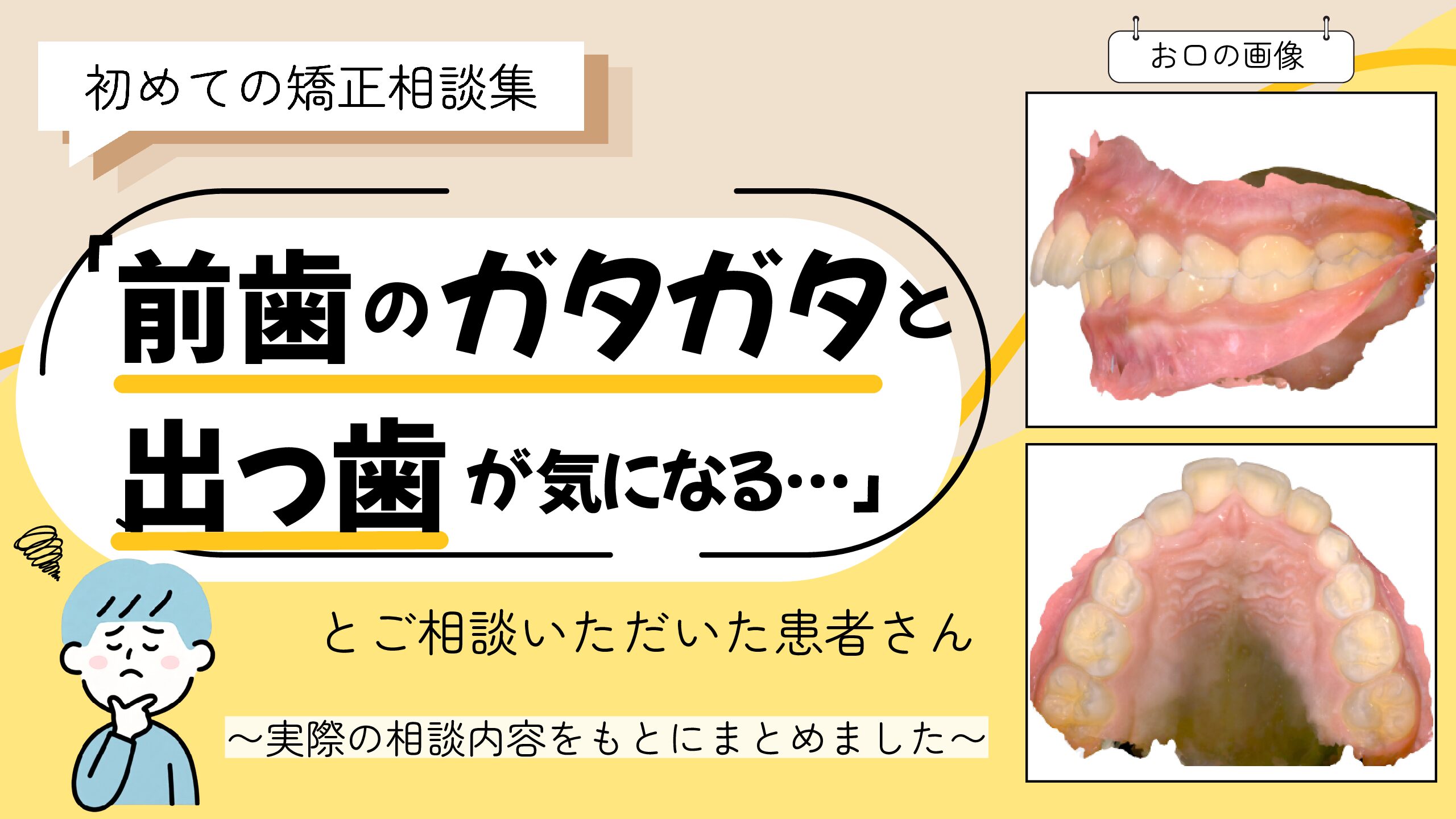「前歯のガタガタと出っ歯が気になる…」とご相談いただいたS.Nさん（8歳・男の子）のケース