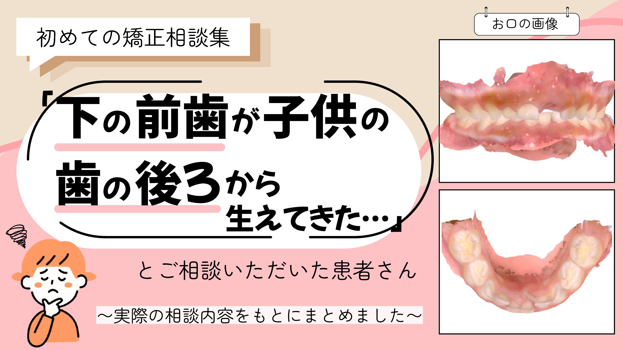 「下の前歯が子供の歯の後ろから生えてきた」とご相談いただいた T.Iさん（6歳・女の子）のケース