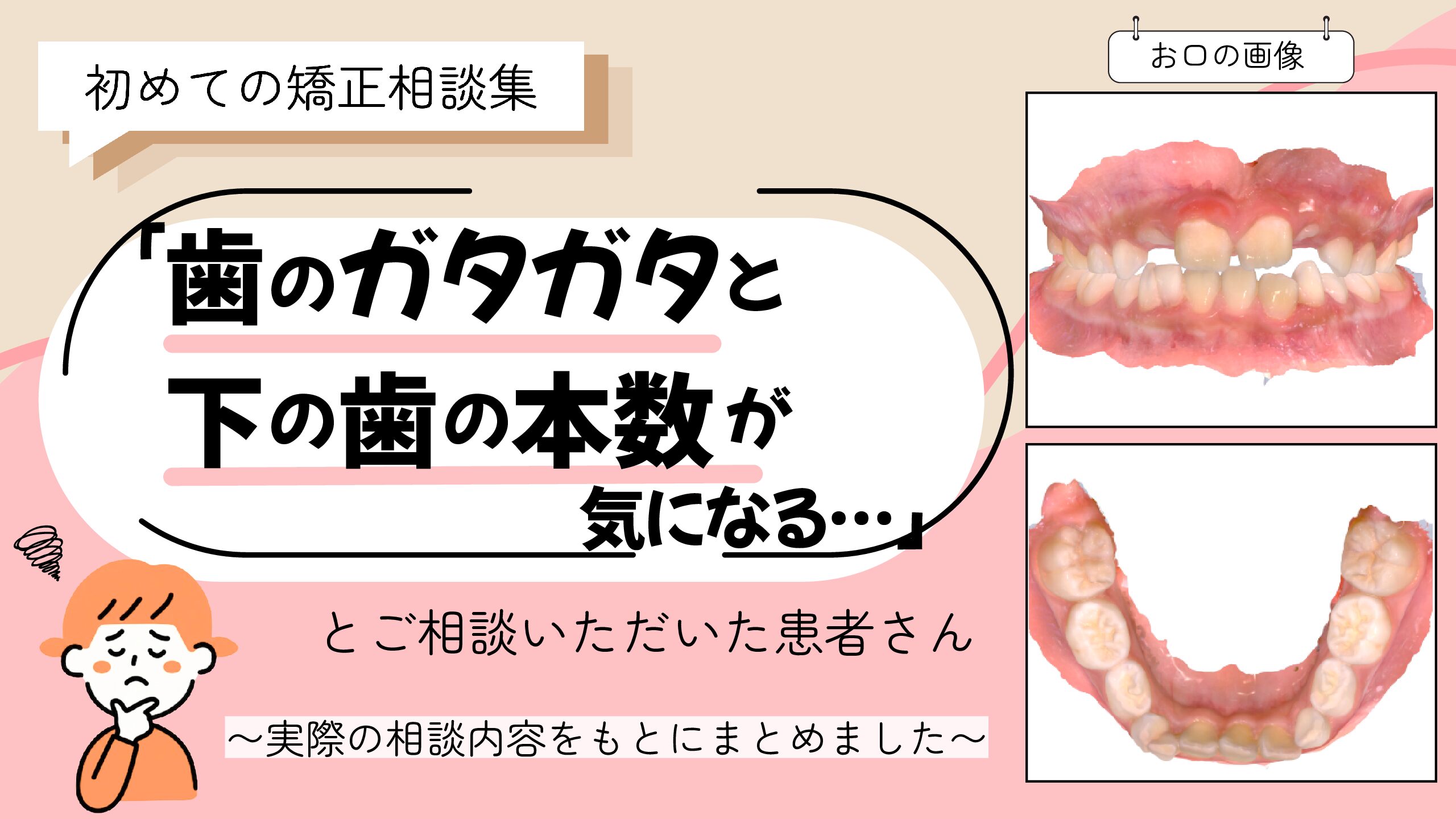 「歯のガタガタと下の歯の本数が気になる…」とご相談いただいたW.Mさん（９歳・女の子）のケース