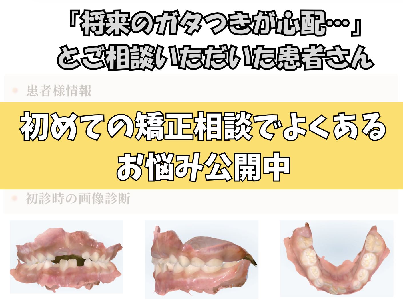 「将来のガタつきが心配…」とご相談いただいた K.Mさん（6歳・女の子）のケース