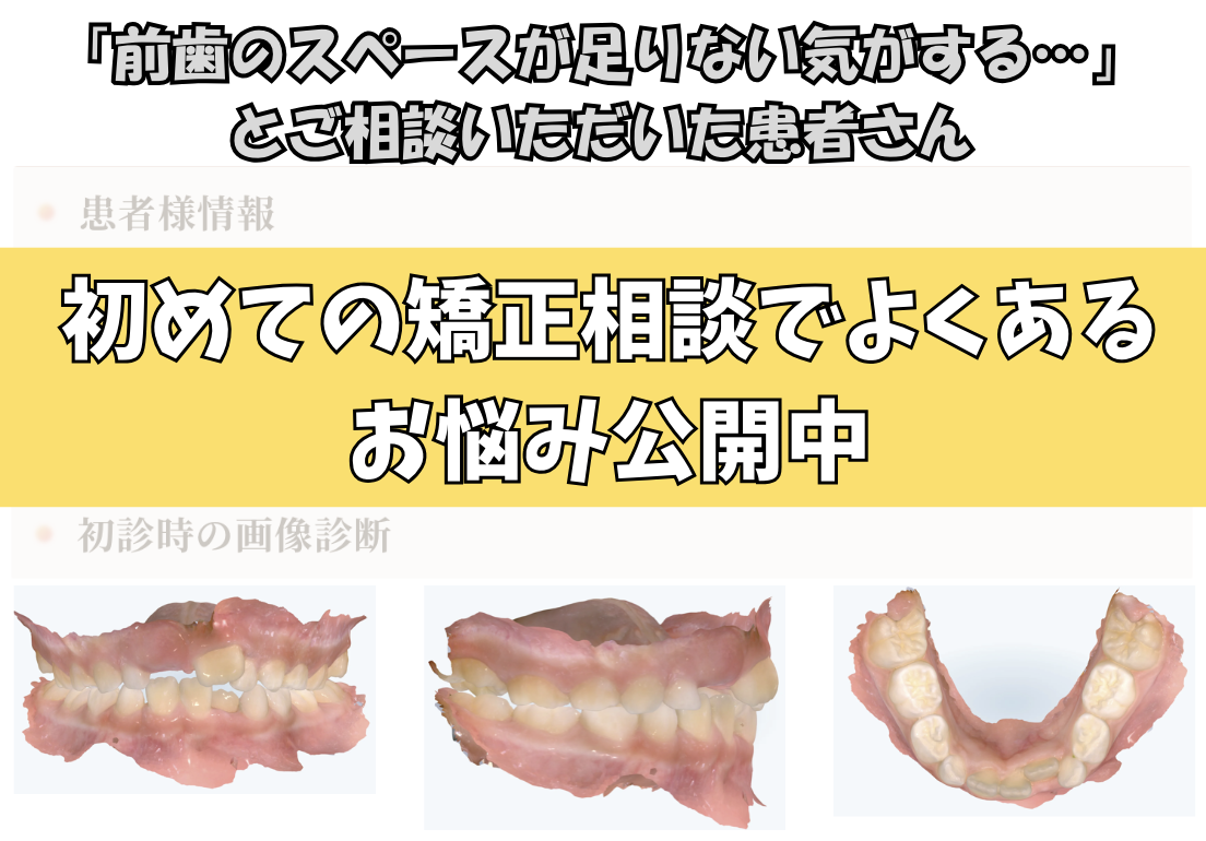 「前歯のスペースが足りない気がする…」とご相談いただいたY.Mさん（7歳・女の子）のケース