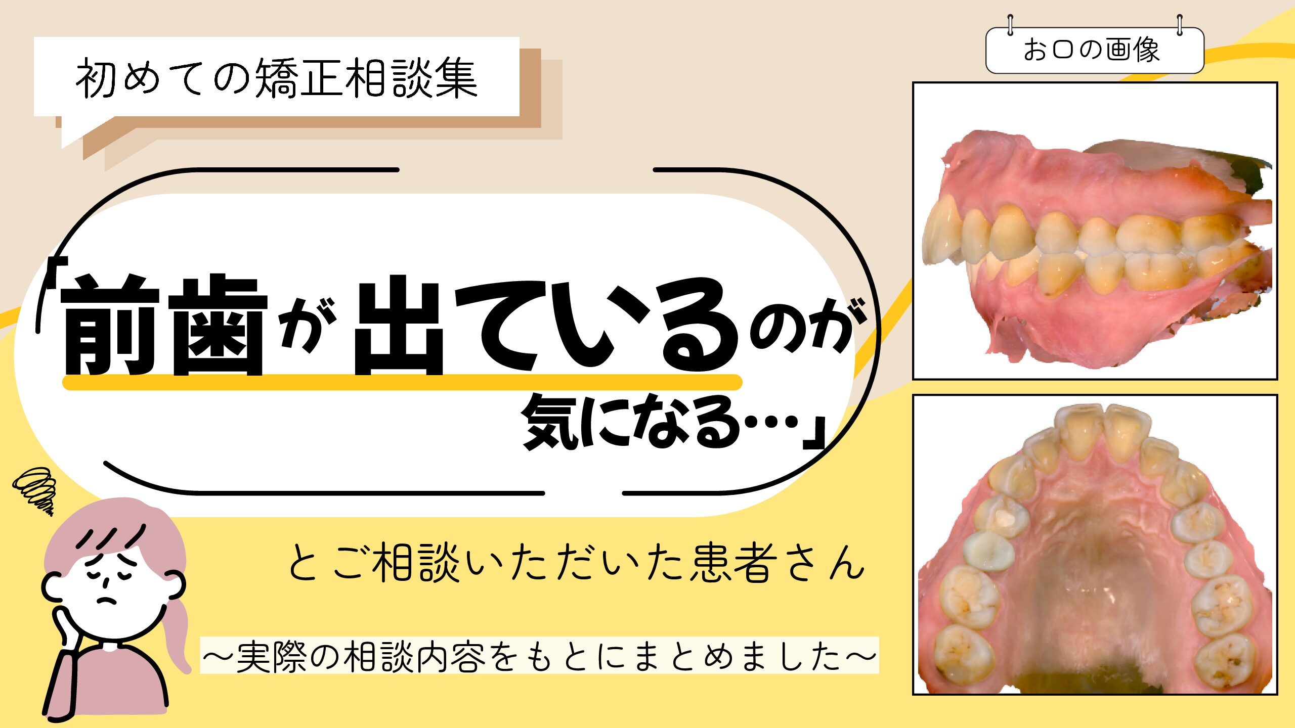 「前歯が出ているのが気になる」とご相談いただいた 　女性のケース　