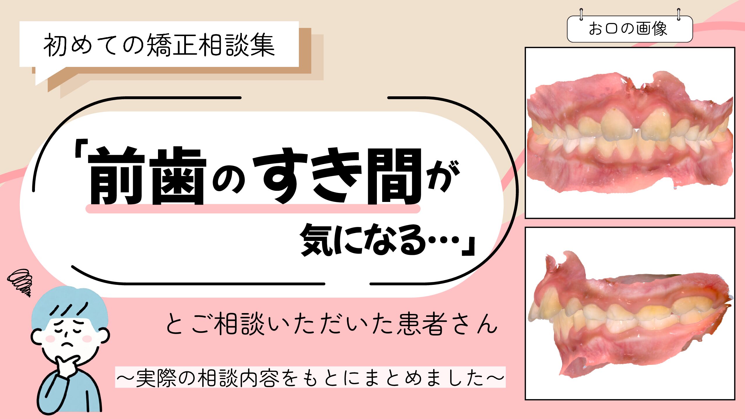 「前歯のすき間が気になる…」とご相談いただいた7歳・男の子のケース