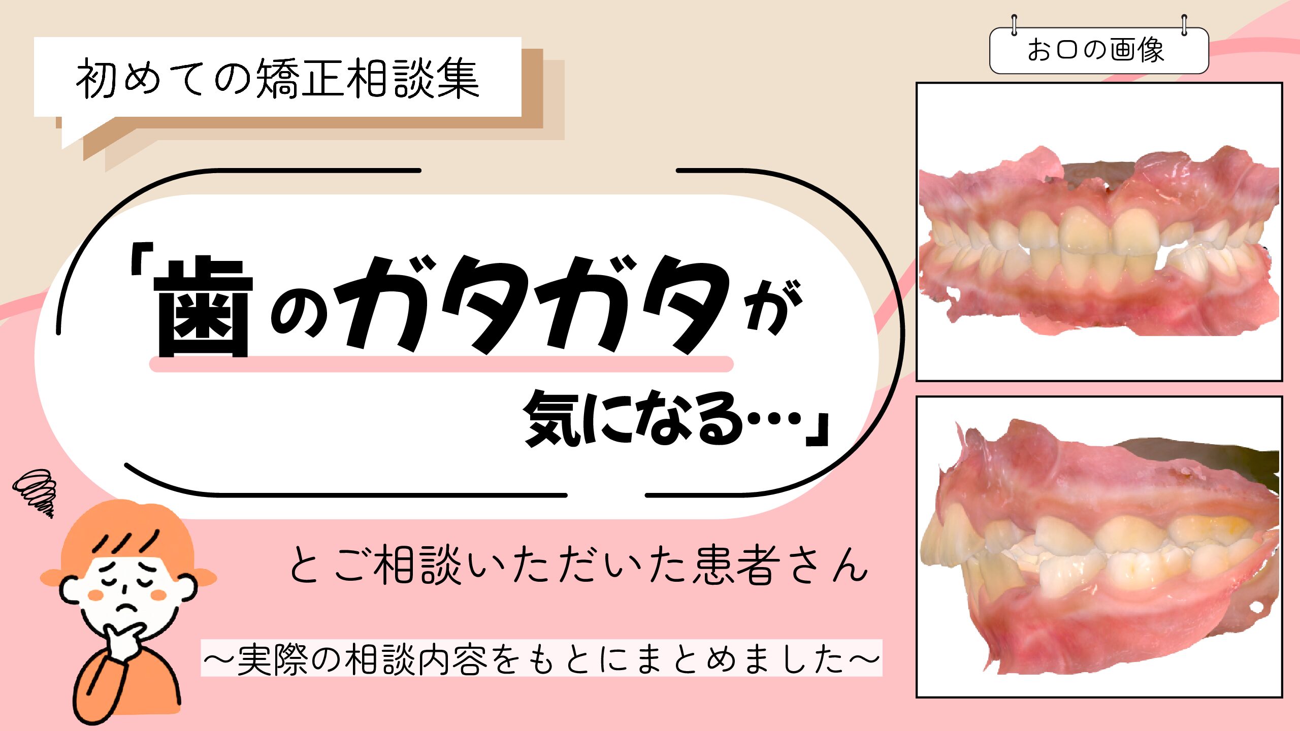 「歯のガタガタが気になる…」とご相談いただいた8歳・女の子のケース