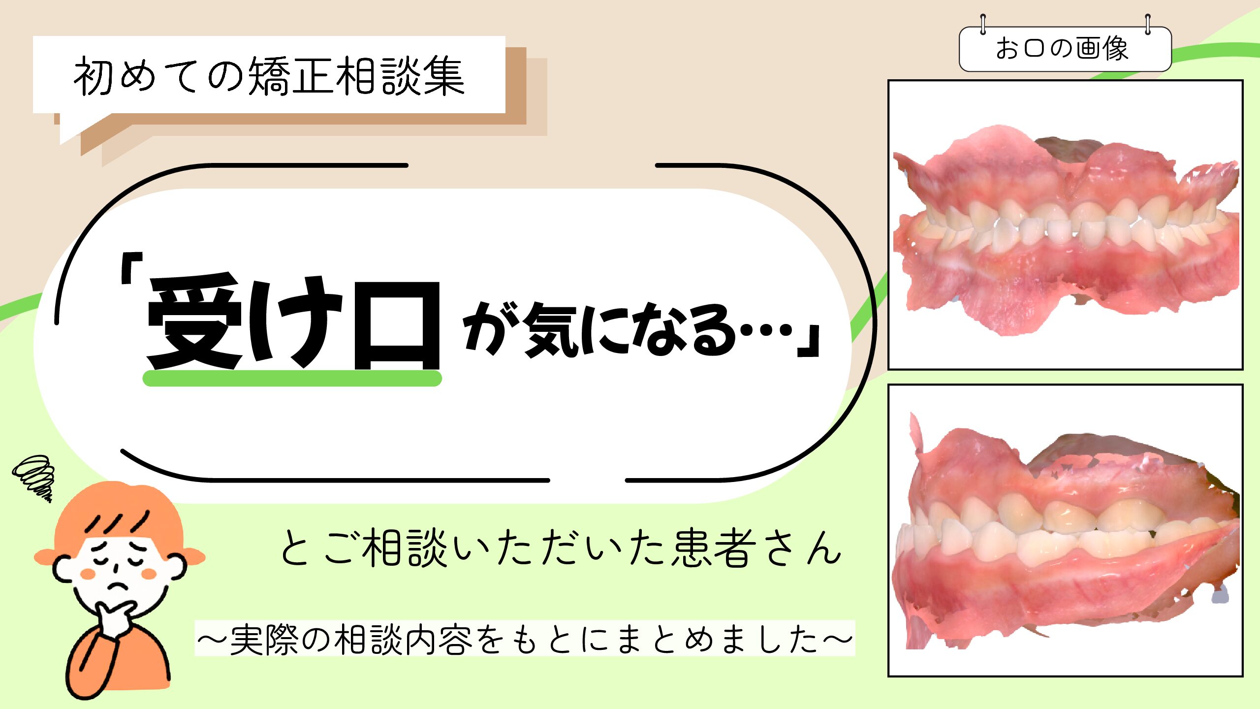「受け口が気になる…」とご相談いただいたE.Mさん（5歳・女の子）のケース