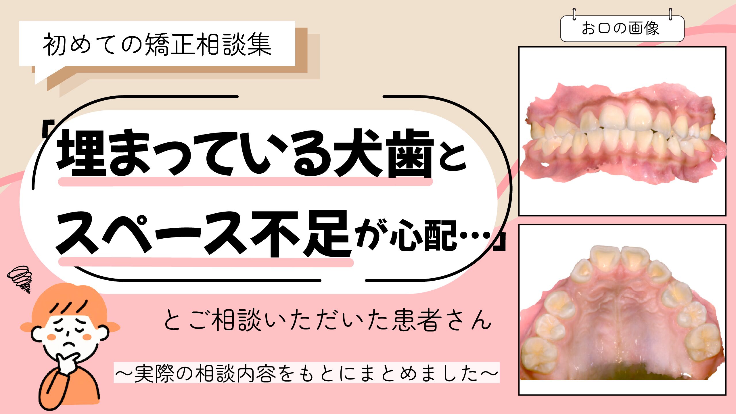 「埋まっている犬歯とスペース不足が心配…」とご相談いただいたH.Mさん（10歳・女の子）のケース