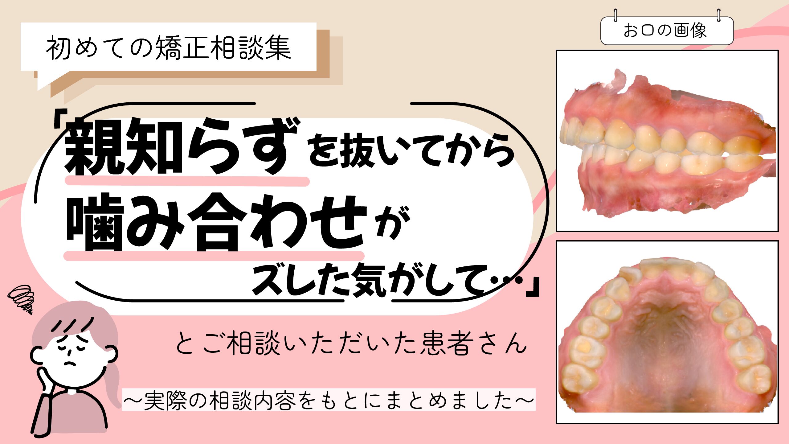 親知らず 抜歯 下 の 歯