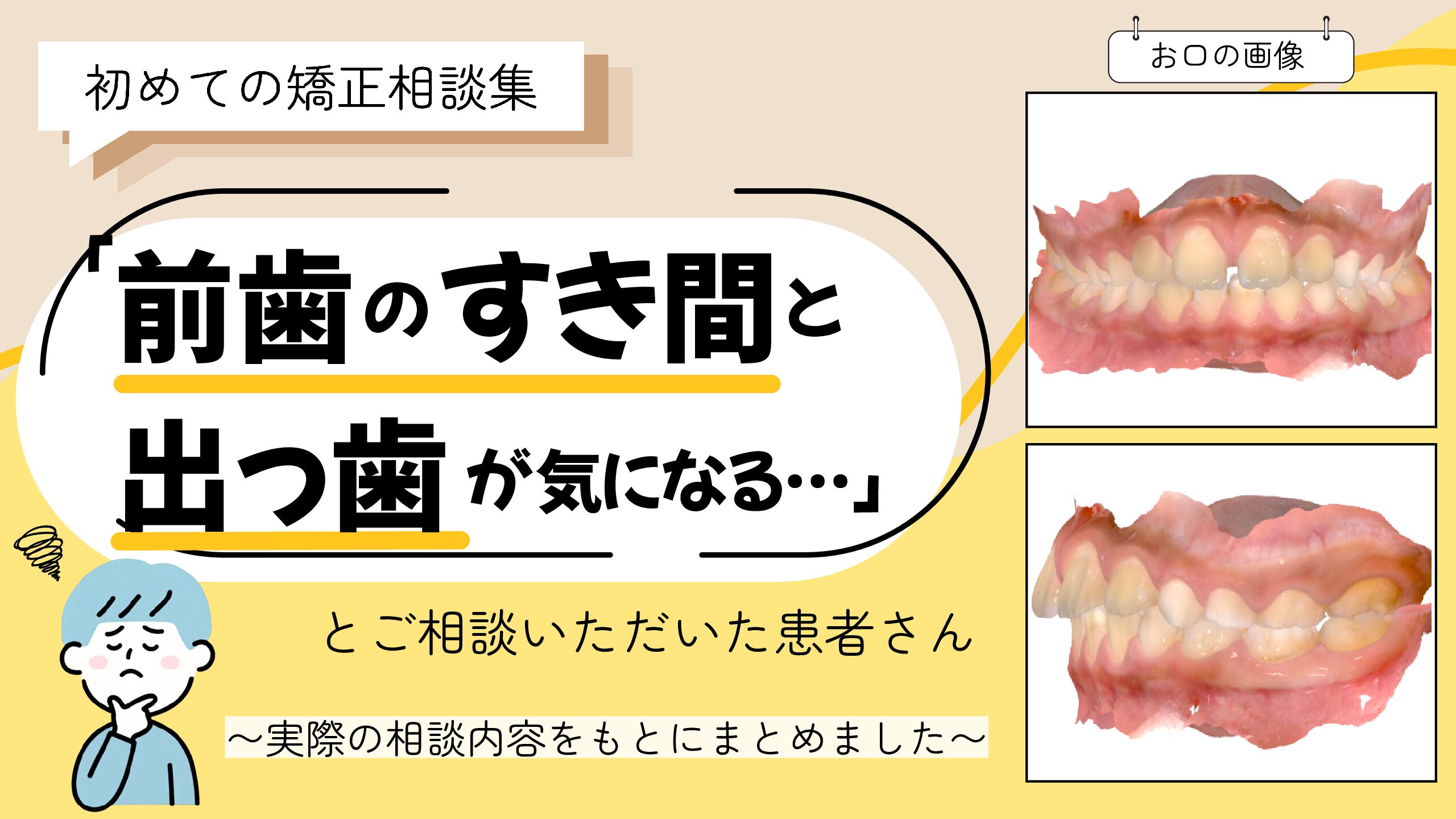 「前歯のすき間と出っ歯が気になる…」とご相談いただいたI.Mさん（8歳・男の子）のケース