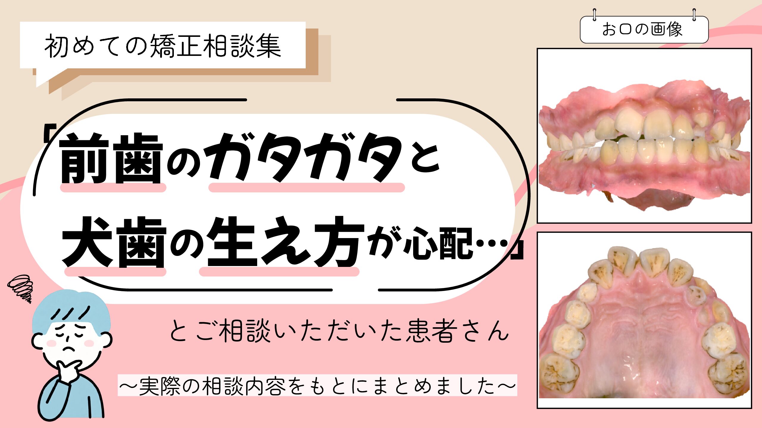 「前歯のガタガタと犬歯の生え方が心配…」とご相談いただいたK.Nさん（12歳・男の子）のケース