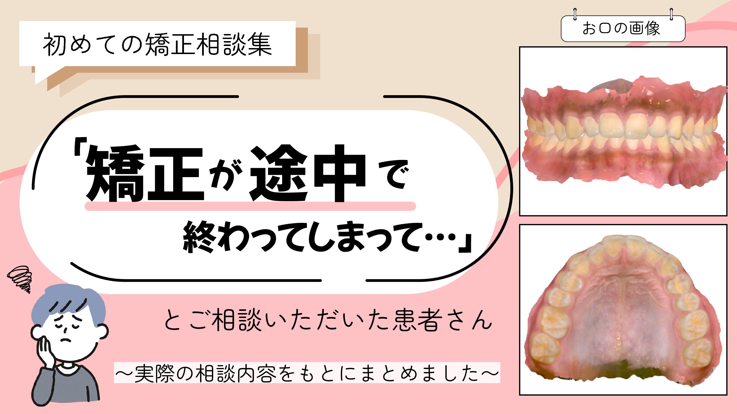 「矯正が途中で終わってしまって…」とご相談いただいたS.Sさん（17歳・男の子）のケース