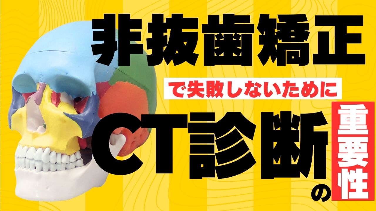 非抜歯矯正で失敗しないために｜よくあるトラブルとCT診断の重要性