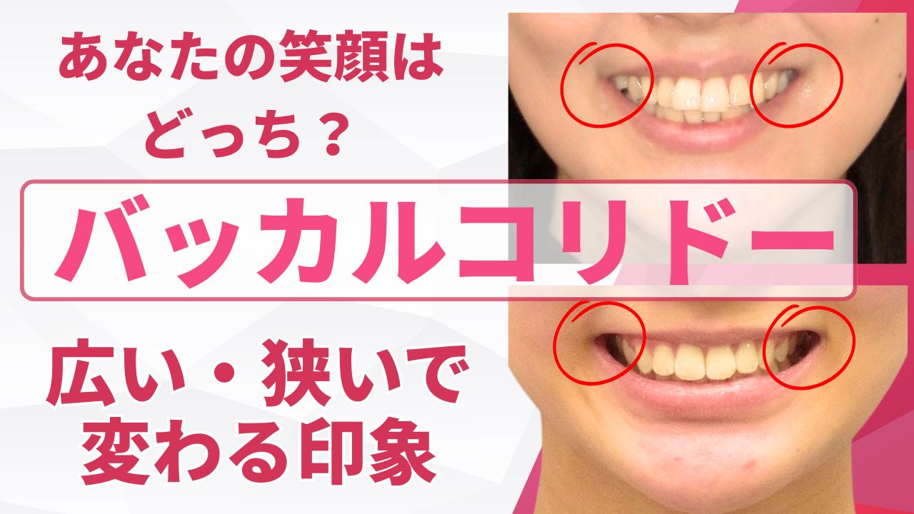 あなたの笑顔はどっち？バッカルコリドーの広い・狭いで変わる印象