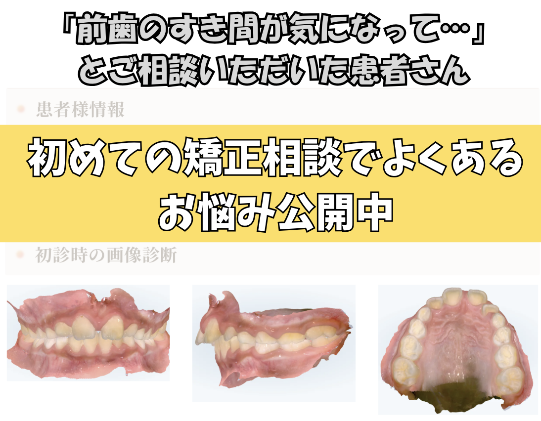 「前歯のすき間が気になって…」とご相談いただいた7歳・男の子のケース